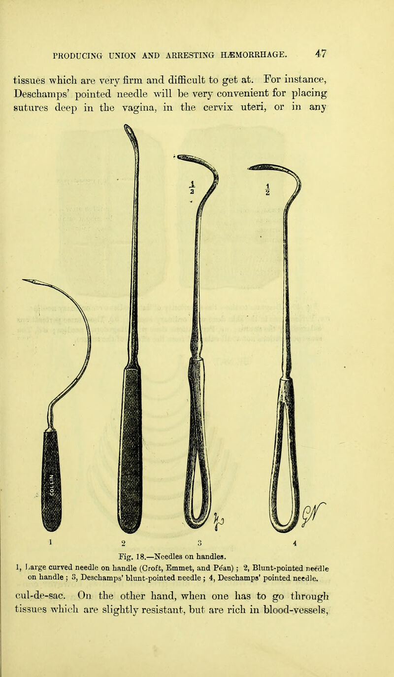 tissues which are very firm and difficult to get at. For instance, Deschamps' pointed needle will be very convenient for placing sutures deep in the vagina, in the cervix uteri, or in any 12 3 4 Fig. 18.—Needles on handles. 1, Urge curved needle on handle (Croft, Emmet, and Pe'an); 2, Blunt-pointed needle on handle ; 3, Deschamps' blunt-pointed needle ; 4, Deschamps' pointed needle. cul-de-sac. On the other hand, when one has to go through tissues which are slightly resistant, but are rich in blood-vessels,