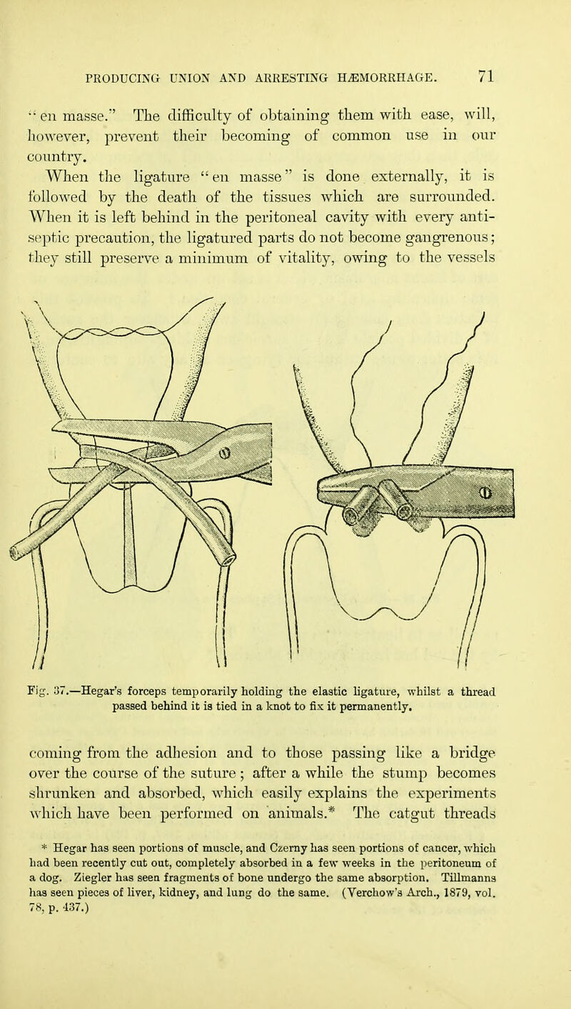 ••en masse.'' The difficulty of obtaining them with, ease, will, however, prevent their becoming of common use in our country. When the ligature  en masse is done externally, it is followed by the death of the tissues which are surrounded. When it is left behind in the peritoneal cavity with every anti- septic precaution, the ligatured parts do not become gangrenous; they still preserve a minimum of vitality, owing to the vessels Fig. 37.—Hegar's forceps temporarily holding the elastic ligature, whilst a thread passed behind it is tied in a knot to fix it permanently. coming from the adhesion and to those passing like a bridge over the course of the suture ; after a while the stump becomes shrunken and absorbed, which easily explains the experiments which have been performed on animals.* The catgut threads * Hegar has seen portions of muscle, and Czerny has seen portions of cancer, which had been recently cut out, completely absorbed in a few weeks in the peritoneum of a dog. Ziegler has seen fragments of bone undergo the same absorption. Tillmanns has seen pieces of liver, kidney, and lung do the same. (Verchow's Arch., 1879, vol. 78, p. 437.)