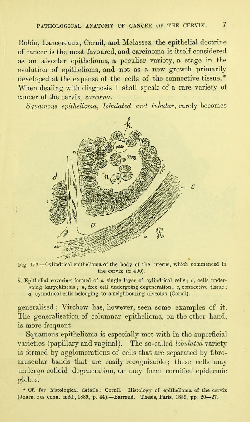 Kobin, Lancereaux, Cornil, and Malassez, the epithelial doctrine of cancer is the most favoured, and carcinoma is itself considered as an alveolar epithelioma, a peculiar variety, a stage in the evolution of epithelioma, and not as a new growth primarily developed at the expense of the cells of the connective tissue. * When dealing with diagnosis I shall speak of a rare variety of cancer of the cervix, sarcoma. Squamous epithelioma, lobulated ami tuiular, rarely becomes Fig. 178.—Cylindrical epithelioma of the body of the uterus, which commenced in the cervix (x 400). 0, Epithelial covering formed of a single layer of cylindrical cells ; le, cells under- going karyokinesis ; n, free cell undergoing degeneration ; c, connective tissue ; d. cylindrical cells belonging to a neighbouring alveolus (Cornil). generalised ; Virchow has, however, seen some examples of it. The generalisation of columnar epithelioma, on the other hand, is more frequent. Squamous epithelioma is especially met with in the superficial varieties (papillary and vaginal). The so-called lobulated variety is formed by agglomerations of cells that are separated by fibro- muscular bands that are easily recognisable ; these cells may undergo colloid degeneration, or may form cornified epidermic globes. * Cf. for histological details: Cornil. Histology of epithelioma of the cervix (Journ. des conn, me'd., 1889, p. 44).—Barraud. Thesis, Paris, 1889, pp. 20—27.