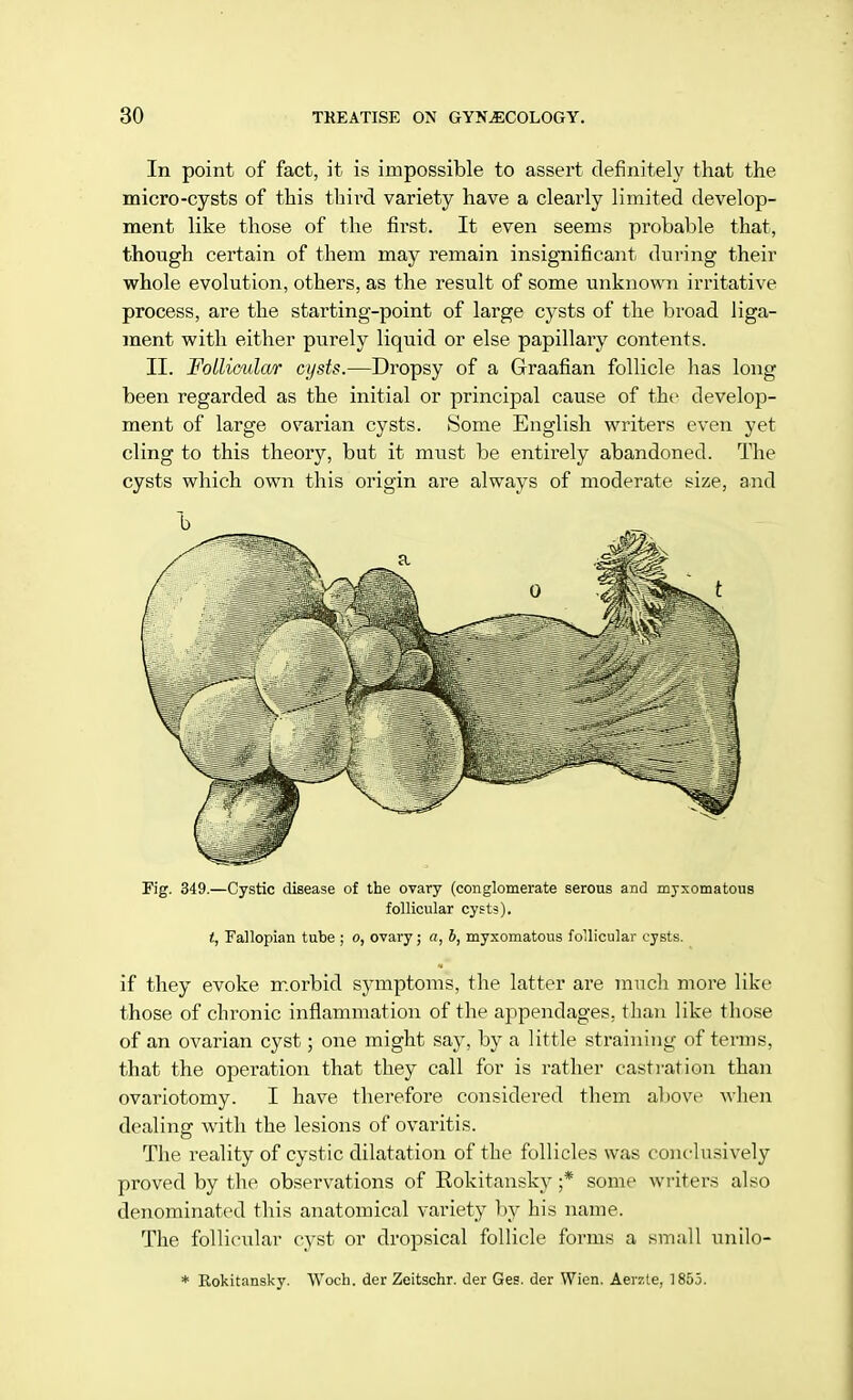 In point of fact, it is impossible to assert definitely that the micro-cysts of this third variety have a clearly limited develop- ment like those of the first. It even seems probable that, though certain of them may remain insignificant during their whole evolution, others, as the result of some unknown irritative process, are the starting-point of large cysts of the broad liga- ment with either purely liquid or else papillary contents. II. Follicular cysts.—Dropsy of a Graafian follicle has long been regarded as the initial or principal cause of the develop- ment of large ovarian cysts. Some English writers even yet cling to this theory, but it must be entirely abandoned. The cysts which own this origin are always of moderate size, and Fig. 349.—Cystic disease of the ovary (conglomerate serous and myxomatous follicular cysts). t, Fallopian tube ; o, ovary; a, b, myxomatous follicular cysts. if they evoke morbid symptoms, the latter are much more like those of chronic inflammation of the appendages, than like those of an ovarian cyst; one might say, by a little straining of terms, that the operation that they call for is rather castration than ovariotomy. I have therefore considered them above when dealing with the lesions of ovaritis. The reality of cystic dilatation of the follicles was conclusively proved by the observations of Rokitansky ;* some writers also denominated this anatomical variety by his name. The follicular cyst or dropsical follicle forms a small unilo- * Rokitansky. Woch. der Zeitschr. der Ges. der Wien. Aerzte, 1855.