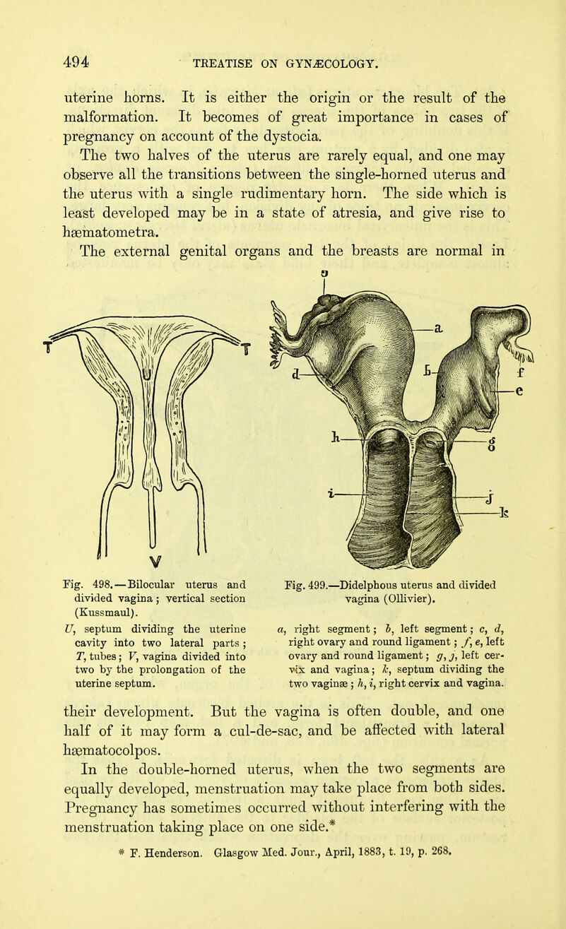 iiterine horns. It is either the origin or the result of the malformation. It becomes of great importance in cases of pregnancy on account of the dystocia. The two halves of the uterus are rarely equal, and one may observe all the transitions between the single-horned uterus and the uterus with a single rudimentary horn. The side which is least developed may be in a state of atresia, and give rise to hasmatometra. The external genital organs and the breasts are normal in Fig. 498.—Bilocular uterus and divided vagina; vertical section (Kussmaul). U, septum dividing the uterine cavity into two lateral parts; T, tubes; V, vagina divided into two by the prolongation of the uterine septum. Fig. 499.—Didelphous uterus and divided vagina (Ollivier). i, right segment; J, left segment; c, d, right ovary and round ligament; f, e, left ovary and round ligament; g, j, left cer- vix and vagina; k, septum dividing the two vaginae ; A, i, right cervix and vagina. their development. But the vagina is often double, and one half of it may form a cul-de-sac, and be affected with lateral hsematocolpos. In the double-horned uterus, when the two segments are equally developed, menstruation may take place from both sides. Pregnancy has sometimes occurred without interfering with the menstruation taking place on one side.* * F. Henderson. Glasgow Med. Jour., April, 1883, t. 19, p. 268.