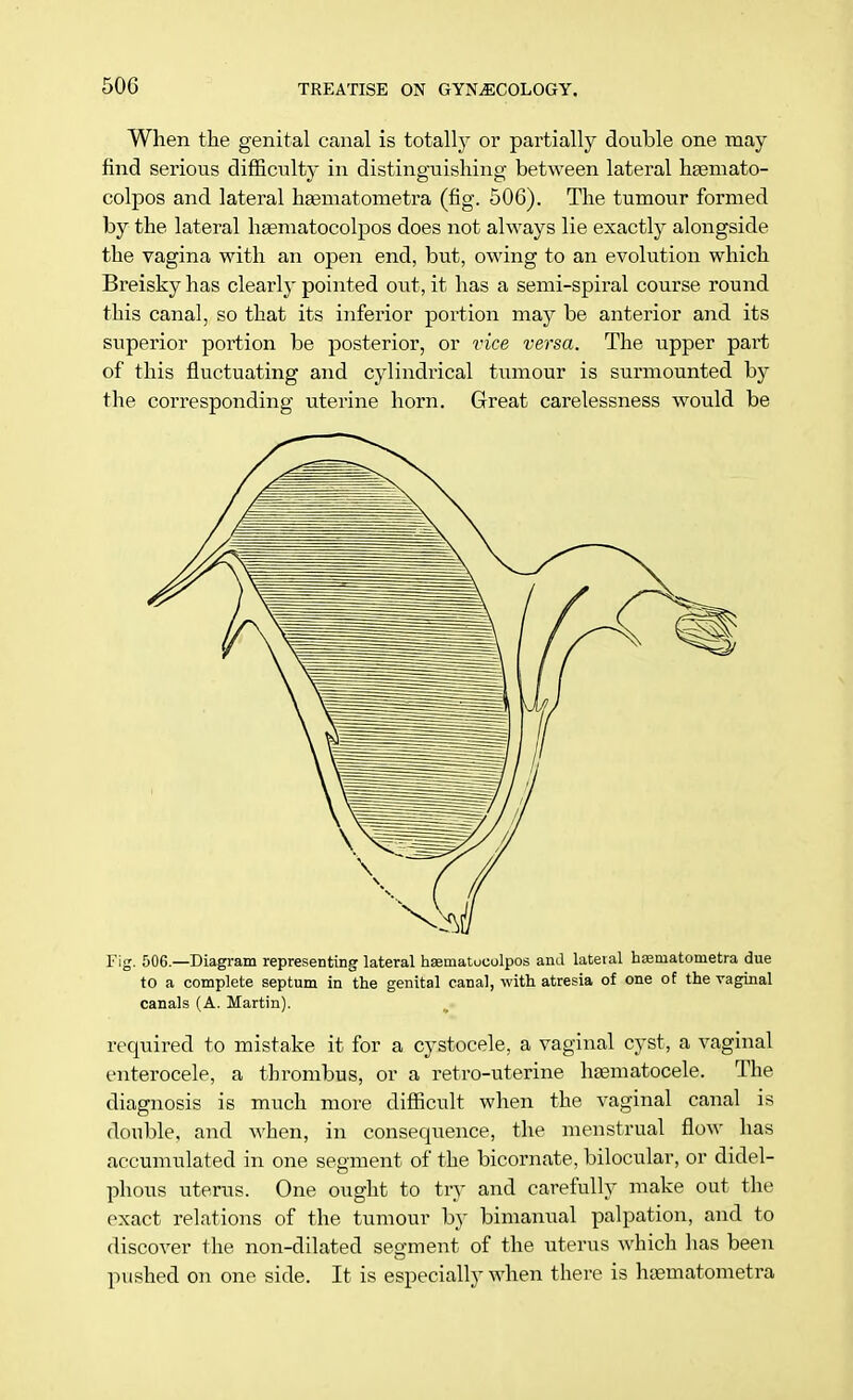 When the genital canal is totally or partially double one may find serious difficulty in distinguishing between lateral liEemato- colpos and lateral hsematometra (fig. 506). The tumour formed by the lateral haematocolpos does not always lie exactly alongside the vagina with an open end, but, owing to an evolution which Breisky has clearly pointed out, it has a semi-spiral course round this canal, so that its inferior portion may be anterior and its superior portion be posterior, or vice versa. The upper part of this fluctuating and cylindrical tumour is surmounted by the corresponding uterine horn. Great carelessness would be Fig. 506.—Diagram representing lateral hsematocolpos and lateral hasrnatonietra due to a complete septum in the genital canal, with atresia of one of the vaginal canals (A. Martin). required to mistake it for a cystocele, a vaginal cyst, a vaginal enterocele, a thrombus, or a retro-uterine haematocele. The diagnosis is much more difficult when the vaginal canal is double, and when, in consequence, the menstrual flow has accumulated in one segment of the bicornate, bilocular, or didel- phous uterus. One ought to try and carefully make out the exact relations of the tumour by bimanual palpation, and to discover the non-dilated segment of the uterus which has been pushed on one side. It is especially when there is hsernatometra