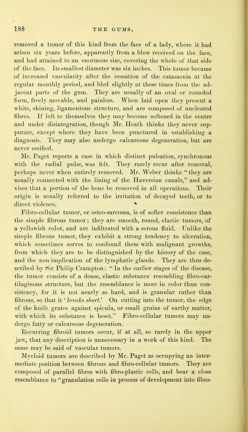 removed a tumor of this kind from the face of a lady, where it had arisen six years before, apparently from a blow received on the face, and had attained to an enormous size, covering the whole of that side of the face. Its smallest diameter was six inches. This tumor became of increased vascularity after the cessation of the catamenia at the regular monthly period, and bled slightly at these times from the ad- jacent parts of the gum. They are usually of an oval or rounded form, freely movable, and painless. When laid open they present a white, shining, ligamentous structure, and are composed of nucleated fibres. If left to themselves they may become softened in the centre and under disintegration, though Mr. Heath thinks they never sup- purate, except where they have been punctured in establishing a diagnosis. They may also undergo calcareous degeneration, but are never ossified. Mr. Paget reports a case in which distinct pulsation, synchronous with the radial pulse, was felt. They rarely recur after removal, perhaps never when entirely removed. Mr. Weber thinks  they are usually connected with the lining of the Haversian canals, aud ad- vises that a portion of the bone be removed in all operations. Their origin is usually referred to the irritation of decayed teeth, or to direct violence. * Fibro-cellular tumor, or osteo-sarcoma, is of softer consistence than the simple fibrous tumor; they are smooth, round, elastic tumors, of a yellowish color, and are infiltrated with a serous fluid. Unlike the simple fibrous tumor, they exhibit a strong tendency to ulceration, which sometimes serves to confound them with malignant growths, from which they are to be distinguished by the history of the case, and the non-implication of the lymphatic glands. They are thus de- scribed by Sir Philip Crampton: In the earlier stages of the disease, the tumor consists of a dense, elastic substance resembling fibro-car- tilaginous structure, but the resemblance is more in color than con- sistency, for it is not nearly so hard, and is granular rather than fibrous, so that it ' breaks short.' On cutting into the tumor, the edge of the knife grates against spicula, or small grains of earthy matter, with which its substance is beset. Fibro-cellular tumors may un- dergo fatty or calcareous degeneration. Recurring fibroid tumors occur, if at all, so rarely in the upper jaw, that any description is unnecessary in a work of this kind. The same may be said of vascular tumors. Myeloid tumors are described by Mr. Paget as occupying an inter- mediate position between fibrous and fibro-cellular tumors. They are composed of parallel fibres with fibro-plastic cells, and bear a close resemblance to granulation cells in process of development into fibro-
