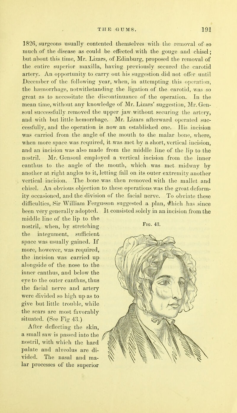 1826, surgeons usually contented themselves with the removal of so much of the disease as could be effected with the gouge and chisel; but about this time, Mr. Lizars, of Edinburg, proposed the removal of the entire superior maxilla, having previously secured the carotid artery. An opportunity to carry out his suggestion did not offer until December of the following year, when, in attempting this operation, the haemorrhage, notwithstanding the ligation of the carotid, was so great as to necessitate the discontinuance of the operation. In the mean time, without any knowledge of Mr. Lizars' suggestion, Mr. Gen- soul successfully removed the upper jaw without securing the artery, and with but little hemorrhage. Mr. Lizars afterward operated suc- cessfully, and the operation is now an established one. His incision was carried from the angle of the mouth to the malar bone, where, when more space was required, it was met by a short, vertical incision, and an incision was also made from the middle line of the lip to the nostril. Mr. Gensoul employed a vertical incision from the inner canthus to the angle of the mouth, which was met midway by another at right angles to it, letting fall on its outer extremity another vertical incision. The bone was then removed with the mallet and chisel. An obvious objection to these operations was the great deform- ity occasioned, and the division of the facial nerve. To obviate these difficulties, Sir William Fergusson suggested a plan, which has since been very generally adopted. It consisted solely in an incision from the middle line of the lip to the nostril, when, hy stretching the integument, sufficient space was usually gained. If more, however, was required, the incision was carried up alongside of the nose to the inner canthus, and below the eye to the outer canthus, thus the facial nerve and artery were divided so high up as to give but little trouble, while the scars are most favorably situated. (See Fig 43.) After deflecting the skin, a small saw is passed into the nostril, with which the hard palate and alveolus are di- vided. The nasal and ma- lar processes of the superior