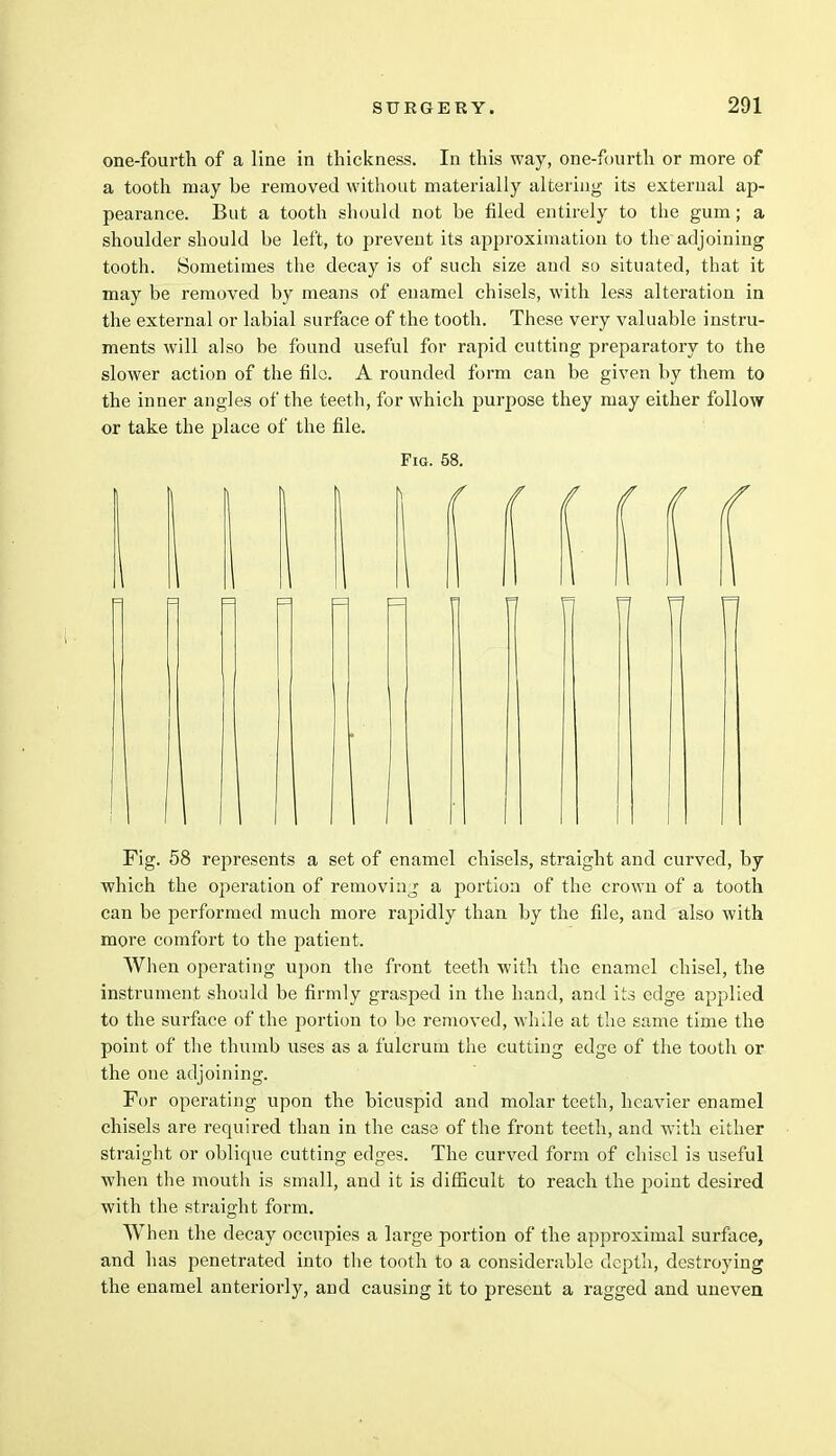 one-fourth of a line in thickness. In this way, one-fourth or more of a tooth may be removed without materially altering its exterual ap- pearance. But a tooth should not be filed entirely to the gum; a shoulder should be left, to prevent its approximation to the adjoining tooth. Sometimes the decay is of such size and so situated, that it may be removed by means of enamel chisels, with less alteration in the external or labial surface of the tooth. These very valuable instru- ments will also be found useful for rapid cutting preparatory to the slower action of the file. A rounded form can be given by them to the inner angles of the teeth, for which purpose they may either follow or take the place of the file. Fig. 58. Fig. 58 represents a set of enamel chisels, straight and curved, by which the operation of removing a portion of the crown of a tooth can be performed much more rapidly than by the file, and also with more comfort to the patient. When operating upon the front teeth with the enamel chisel, the instrument should be firmly grasped in the hand, and its edge applied to the surface of the portion to be removed, while at the same time the point of the thumb uses as a fulcrum the cutting edge of the tooth or the one adjoining. For operating upon the bicuspid and molar teeth, heavier enamel chisels are required than in the case of the front teeth, and with either straight or oblique cutting edges. The curved form of chisel is useful when the mouth is small, and it is difficult to reach the point desired with the straight form. When the decay occupies a large portion of the approximal surface, and has penetrated into the tooth to a considerable depth, destroying the enamel anteriorly, and causing it to present a ragged and uneven