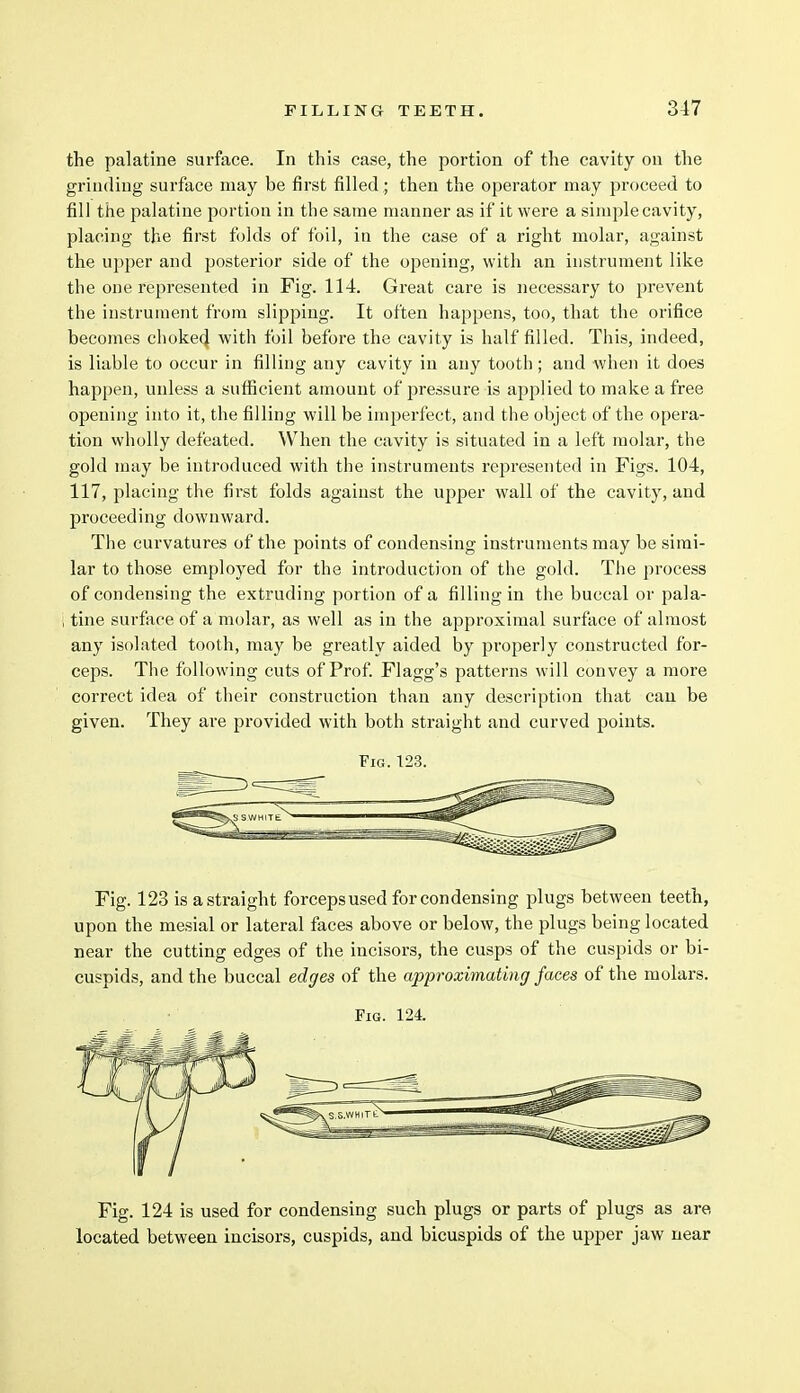 the palatine surface. In this case, the portion of the cavity on the grinding surface may be first filled ; then the operator may proceed to fill the palatine portion in the same manner as if it were a simple cavity, placing the first folds of foil, in the case of a right molar, against the upper and posterior side of the opening, with an instrument like the one represented in Fig. 114. Great care is necessary to prevent the instrument from slipping. It often happens, too, that the orifice becomes choked with foil before the cavity is half filled. This, indeed, is liable to occur in filling any cavity in any tooth ; and when it does happen, unless a sufficient amount of jiressure is applied to make a free opening into it, the filling will be imperfect, and the object of the opera- tion wholly defeated. When the cavity is situated in a left molar, the gold may be introduced with the instruments represented in Figs. 104, 117, placing the first folds against the upper wall of the cavity, and proceeding downward. The curvatures of the points of condensing instruments may be simi- lar to those employed for the introduction of the gold. The process of condensing the extruding portion of a filling in the buccal or pala- ; tine surface of a molar, as well as in the approximal surface of almost any isolated tooth, may be greatly aided by jn'operly constructed for- ceps. The following cuts of Prof. Flagg's patterns will convey a more correct idea of their construction than any description that can be given. They are provided with both straight and curved points. Fig. 123. Fig. 123 is a straight forceps used for condensing plugs between teeth, upon the mesial or lateral faces above or below, the plugs being located near the cutting edges of the incisors, the cusps of the cuspids or bi- cuspids, and the buccal edges of the approximating faces of the molars. Fig. 124. Fig. 124 is used for condensing such plugs or parts of plugs as are located between incisors, cuspids, and bicuspids of the upper jaw near