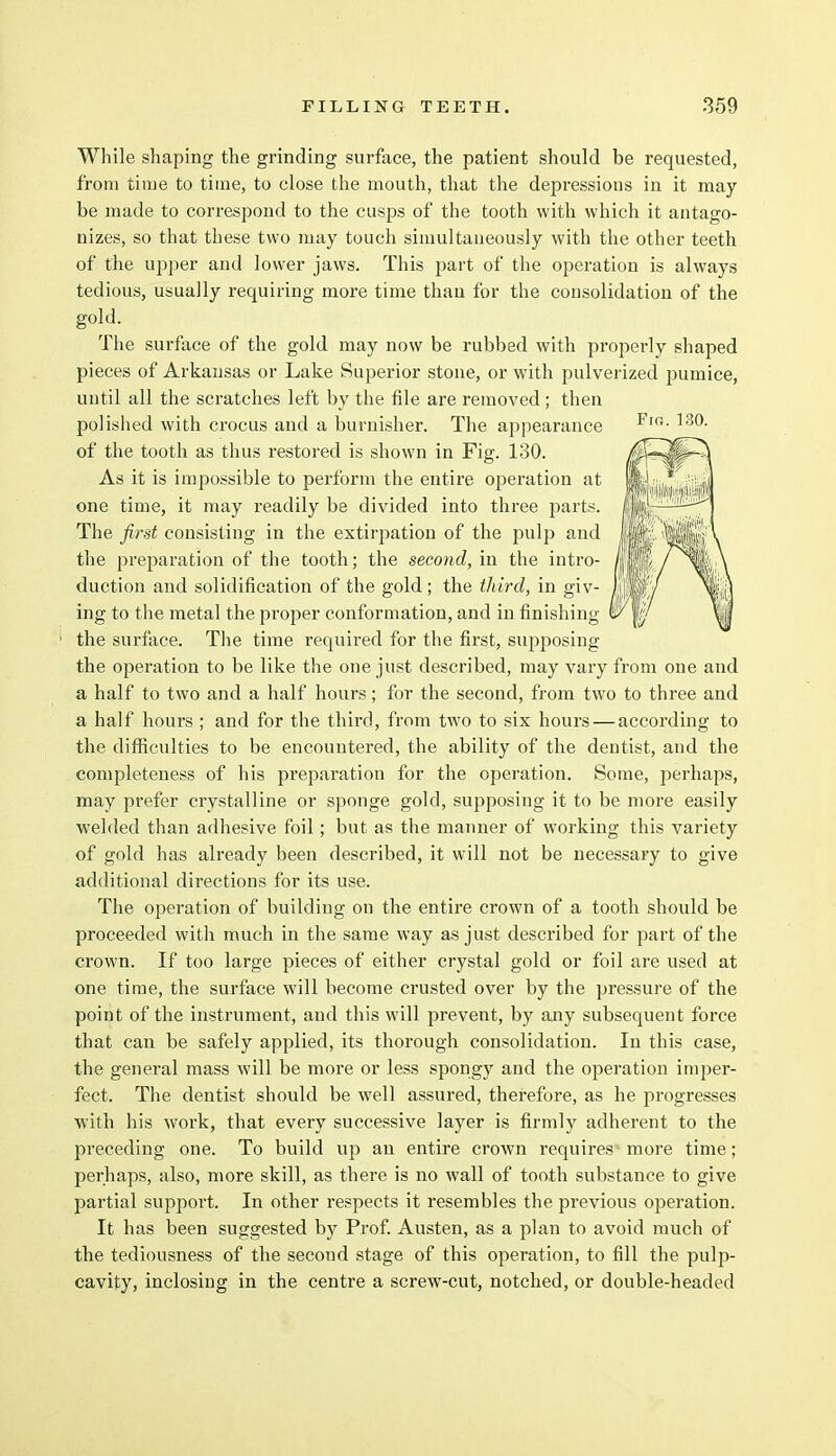 While shaping the grinding surface, the patient should be requested, from time to time, to close the mouth, that the depressions in it may be made to correspond to the cusps of the tooth with which it antago- nizes, so that these two may touch simultaneously with the other teeth of the upper and lower jaws. This part of the operation is always tedious, usually requiring more time than for the consolidation of the gold. The surface of the gold may now be rubbed with properly shaped pieces of Arkansas or Lake Superior stone, or with pulverized pumice, until all the scratches left by the file are removed ; then polished with crocus and a burnisher. The appearance of the tooth as thus restored is shown in Fig. 130. As it is impossible to perform the entire operation at one time, it may readily be divided into three parts. The first consisting in the extirpation of the pulp and the preparation of the tooth; the second, in the intro- duction and solidification of the gold ; the third, in giv- ing to the metal the proper conformation, and in finishing the surface. The time required for the first, supposing the operation to be like the one just described, may vary from one and a half to two and a half hours; for the second, from two to three and a half hours ; and for the third, from two to six hours — according to the difficulties to be encountered, the ability of the dentist, and the completeness of his preparation for the operation. Some, perhaps, may prefer crystalline or sponge gold, supposing it to be more easily welded than adhesive foil; but as the manner of working this variety of gold has already been described, it will not be necessary to give additional directions for its use. The operation of building on the entire crown of a tooth should be proceeded with much in the same way as just described for part of the crown. If too large pieces of either crystal gold or foil are used at one time, the surface will become crusted over by the pressure of the point of the instrument, and this will prevent, by any subsequent force that can be safely applied, its thorough consolidation. In this case, the general mass will be more or less spongy and the operation imper- fect. The dentist should be well assured, therefore, as he progresses with his work, that every successive layer is firmly adherent to the preceding one. To build up an entire crown requires more time; perhaps, also, more skill, as there is no wall of tooth substance to give partial support. In other respects it resembles the previous operation. It has been suggested by Prof. Austen, as a plan to avoid much of the tediousness of the second stage of this operation, to fill the pulp- cavity, inclosing in the centre a screw-cut, notched, or double-headed