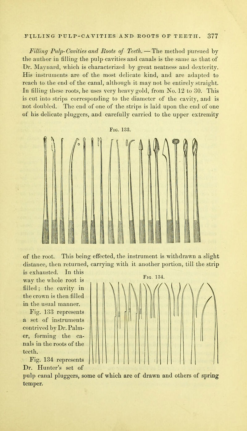 Filling Pulp- Cavities and Roots of Teeth. — The method pursued by the author in filling the pulp cavities and canals is the same as that of Dr. Maynard, which is characterized by great neatness and dexterity. His instruments are of the most delicate kind, and are adapted to reach to the end of the canal, although it may not be entirely straight. In filling these roots, he uses very heavy gold, from No. 12 to 80. This is cut into strips corresponding to the diameter of the cavity, and is not doubled. The end of one of the strips is laid upon the end of one of his delicate pluggers, and carefully carried to the upper extremity Fig. 133. of the root. This being effected, the instrument is withdrawn a slight distance, then returned, carrying with it another portion, till the strip is exhausted. In this way the whole root is filled; the cavity in the crown is then filled in the usual manner. Fig. 133 represents a set of instruments contrived by Dr. Palm- er, forming the ca- nals in the roots of the teeth. Fig. 134 represents Dr. Hunter's set of pulp canal pluggers, some of which are of drawn and others of spring temper.