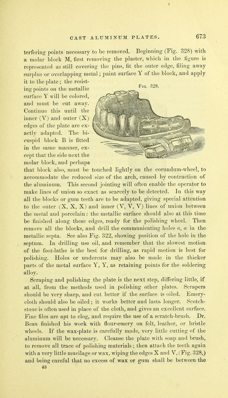 Fig. 328. terfering points necessary to be removed. Beginning (Fig. 328) with a molar block M, first removing the plaster, which in the figure is represented as still covering the pins, fit the outer edge, filing away surplus or overlapping metal; paint surface Y of the block, and apply it to the plate ; the resist- ing points on the metallic surface Y will be colored, and must be cut away. Continue this until the inner (V) and outer (X) edges of the plate are ex- actly adapted. The bi- cuspid block B is fitted in the same manner, ex- cept that the side next the molar block, and perhaps that block also, must be touched lightly on the corundum-wheel, to accommodate the reduced size of the arch, caused by contraction of the aluminum. This second jointing will often enable the operator to make lines of union so exact as scarcely to be detected. In this way all the blocks or gum teeth are to be adapted, giving special attention to the outer (X, X, X) and inner (V, V, V) lines of union between the metal and porcelain: the metallic surface should also at this time be finished along these edges, ready for the polishing wheel. Then remove all the blocks, and drill the communicating holes a, a in the- metallic septa. See also Fig. 322, showing position of the hole in the septum. In drilling use oil, and remember that the slowest motion of the foot-lathe is the best for drilling, as rapid motion is best for polishing. Holes or undercuts may also be made in the thicker parts of the metal surface Y, Y, as retaining points for the soldering alloy. Scraping and polishing the plate is the next step, differing little, if at all, from the methods used in polishing other plates. Scrapers should be very sharp, and cut better if the surface is oiled. Emery- cloth should also be oiled ; it works better and lasts, longer. Scotch- stone is often used in place of the cloth, and gives an excellent surface. Fine files are apt to clog, and require the use of a scratch-brush. Dr. Bean finished his work with flour-emery on felt, leather, or bristle wheels. If the wax-plate is carefully made, very little cutting of the aluminum will be necessary. Cleanse the plate with soap and brush, to remove all trace of polishing materials ; then attach the teeth again with a very little mucilage or wax, wiping the edges X and V, (Fig. 328,) and being careful that no excess of wax or gum shall be between the 43