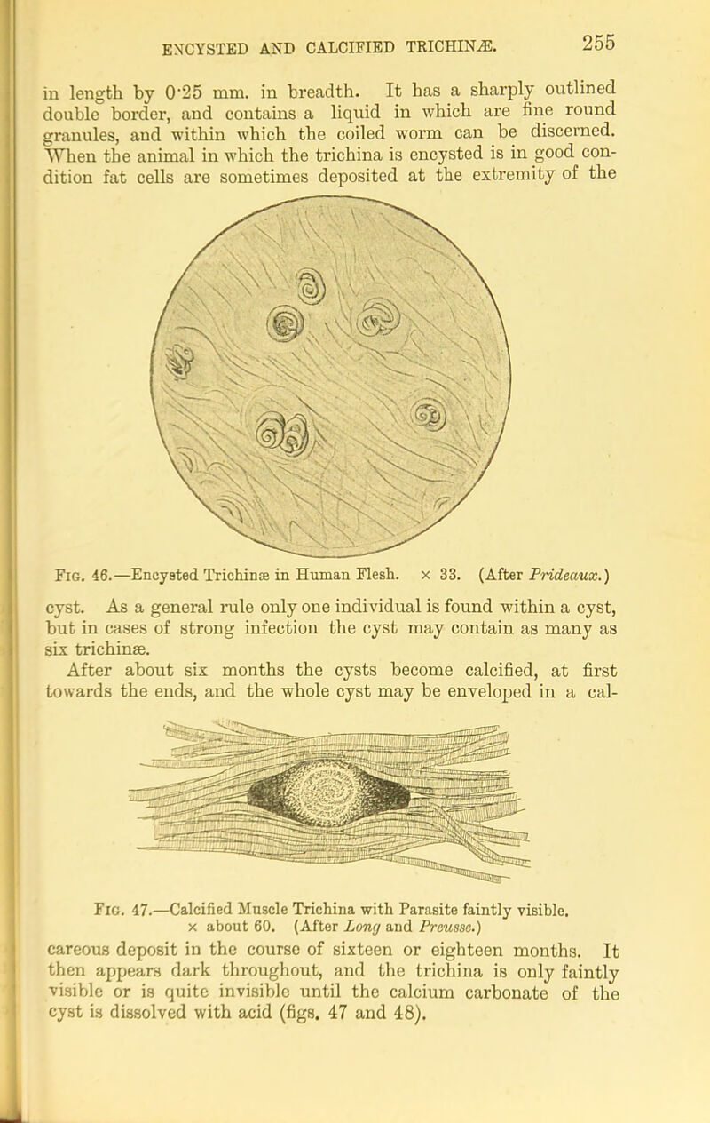 ENCYSTED AND CALCIFIED TRICHINAE. in length by 0'25 mm. in breadth. It has a sharply outlined double border, and contains a liquid in which are fine round granules, and within which the coiled worm can be discerned. When the animal in which the trichina is encysted is in good con- dition fat cells are sometimes deposited at the extremity of the Fig. 46.—Encysted Trichinae in Human Flesh, x 33. (After Prideaux.) cyst. As a general rule only one individual is found within a cyst, but in cases of strong infection the cyst may contain as many as six trichime. After about six months the cysts become calcified, at first towards the ends, and the whole cyst may be enveloped in a cal- Fig. 47.—Calcified Muscle Trichina with Parasite faintly visible, x about 60. (After Long and Preusse.) careous deposit in the course of sixteen or eighteen months. It then appears dark throughout, and the trichina is only faintly visible or is quite invisible until the calcium carbonate of tho cyst is dissolved with acid (figs. 47 and 48).