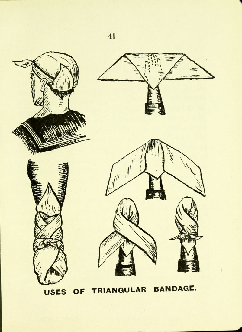 1 41 USES OF TRIANGULAR BANDAGE.