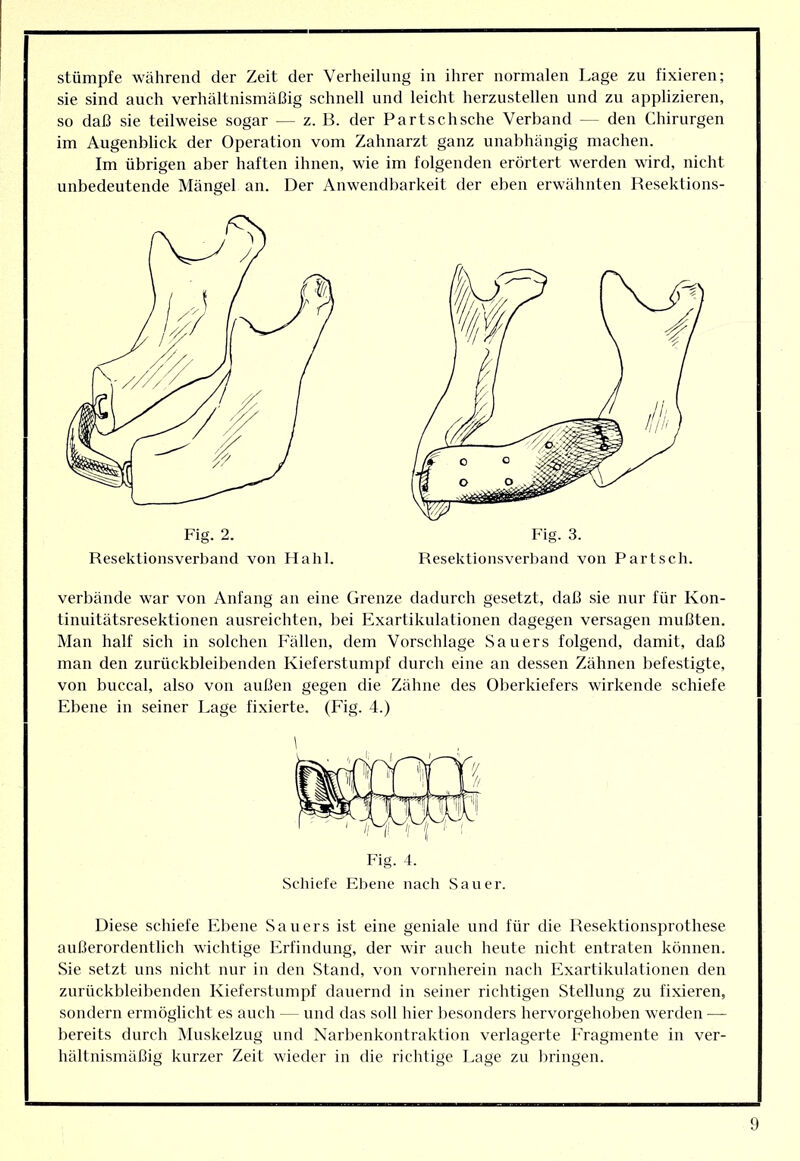 Stümpfe während der Zeit der Verheilung in ihrer normalen Lage zu fixieren; sie sind auch verhältnismäßig schnell und leicht herzustellen und zu applizieren, so daß sie teilweise sogar — z. B. der Partschsche Verband — den Chirurgen im Augenblick der Operation vom Zahnarzt ganz unabhängig machen. Im übrigen aber haften ihnen, wie im folgenden erörtert werden wird, nicht unbedeutende Mängel an. Der Anwendbarkeit der eben erwäbnten Resektions- Fig. 2. Resektionsverband von Hahl. Resektionsverband von Part sch. verbände war von Anfang an eine Grenze dadurch gesetzt, daß sie nur für Kon- tinuitätsresektionen ausreichten, bei Exartikulationen dagegen versagen mußten. Man half sich in solchen Fällen, dem Vorschläge Sauers folgend, damit, daß man den zurückbleibenden Kieferstumpf durch eine an dessen Zähnen befestigte, von buccal, also von außen gegen die Zähne des Oberkiefers wirkende schiefe Ebene in seiner Lage fixierte. (Fig. 4.) Fig. 4. Schiefe Ebene nach Sauer. Diese schiefe Ebene Saners ist eine geniale und für die Resektionsprothese außerordentlich wichtige Erfindung, der wir auch heute nicht entraten können. Sie setzt uns nicht mir in den Stand, von vornherein nach Exartikulationen den znrückbleibenden Kieferstnmpf dauernd in seiner richtigen Stellung zu fixieren, sondern ermöglicht es auch — und das soll hier besonders hervorgehoben werden — bereits durch iNIuskelzug und Narbenkontraklion verlagerte Fragmente in ver- hältnismäßig kurzer Zeit wieder in die richtige Lage zu bringen.