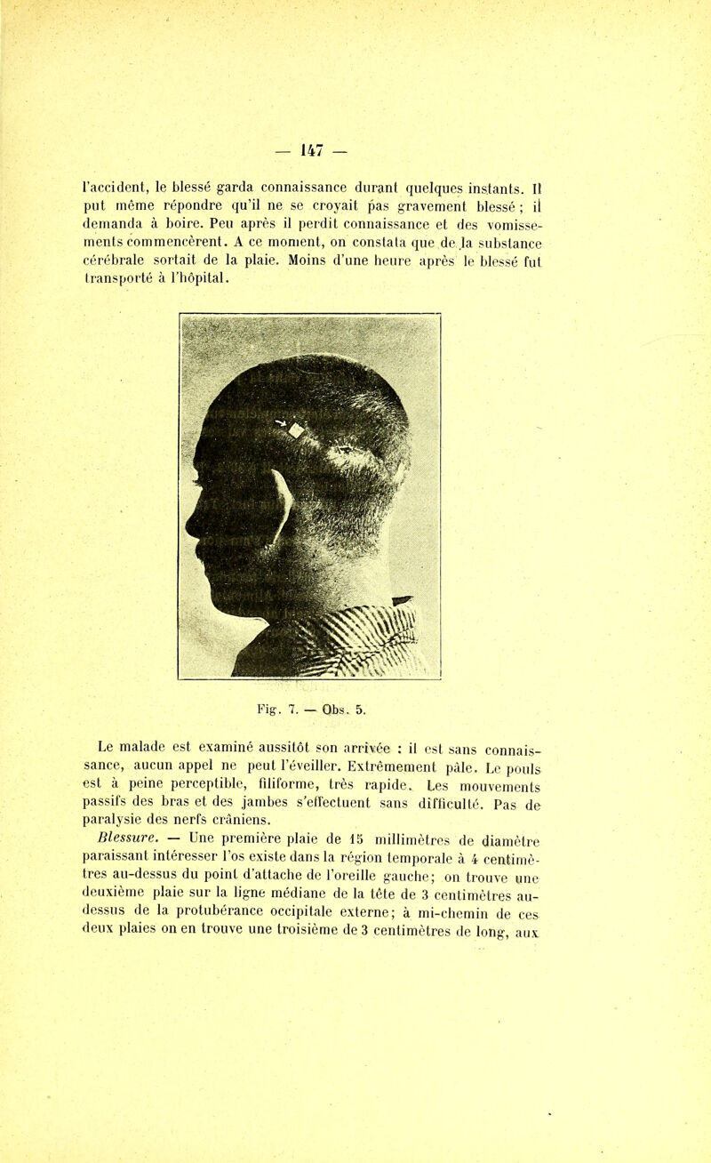 l’accidcnt, le blessé garda connaissance durant quelques instants. Il put même répondre qu’il ne se croyait pas gravement blessé; il demanda à boire. Peu après il perdit connaissance et des vomisse- ments commencèrent. A ce moment, on constata que de ,1a substance cérébrale sortait de la plaie. Moins d’une heure après le blessé fut transporté à l’hôpital. Fig. 7. — Obs. 5. Le malade est examiné aussitôt son arrivée ; il est sans connais- sance, aucun appel ne peut l’éveiller. Extrêmement pâle. Le pouls est à peine perceptible, filiforme, très rapide. Les mouvements passifs des bras et des jambes s’effectuent sans difficulté. Pas de paralysie des nerfs crâniens. Blessure. — Une première plaie de 15 millimètres de diamètre paraissant intéresser l’os existe dans la région temporale à 4 centimè- tres au-dessus du point d’attache de l’oreille gauche; on trouve une deuxième plaie sur la ligne médiane de la tête de 3 centimètres au- dessus de la protubérance occipitale externe; à mi-chemin de ces deux plaies on en trouve une troisième de 3 centimètres de long, aux