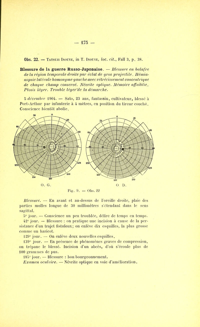 Obs. 22. — Tatsi'ji Inouïe, in T. Inouïe, loc. cit., Fall 3, p. 38. Blessure de la guerre Russo-Japonaise. — Blessure en balafre de la région temporale droite par éclat de gros projectile. Hémia- nopsie latérale homongme gauche avec rétrécissement concentrique de chaque champ conservé. Névrite optique. Mémoire affaiblie. Ptosis léger. Trouble léger'de la démarche. 5 décembre 1904. — Sato, 23 ans, fantassin, cullivateur, blessé à Port-Arthur par infanterie à 4 mètres, en position du tireur couclié. Conscience bientôt abolie. Fis. 9. — Obs. 22 Blessure. — En avant et au-dessus de l’oreille droite, plaie des parties molles longue de 30 millimètres s’étendant dans le sens sagittal. 5'^ jour. — Conscience un peu troublée, délire de temps en temps. 42« jour. — Blessure : on pratique une incision à cause de la per- sistance d’un trajet fistuleux; on enlève dix esquilles, la plus grosse comme un haricot. 129= jour. — On enlève deux nouvelles esquilles, 139= jour. — En présence de phénomènes graves de compression, on trépane le blessé. Incision d’un abcès, d’où s’écoule plus de 100 grammes de pus. 183“ jour. — Blessure : bon bourgeonnement. Examen oculaire. — Névrite optique en voie d’amélioration.