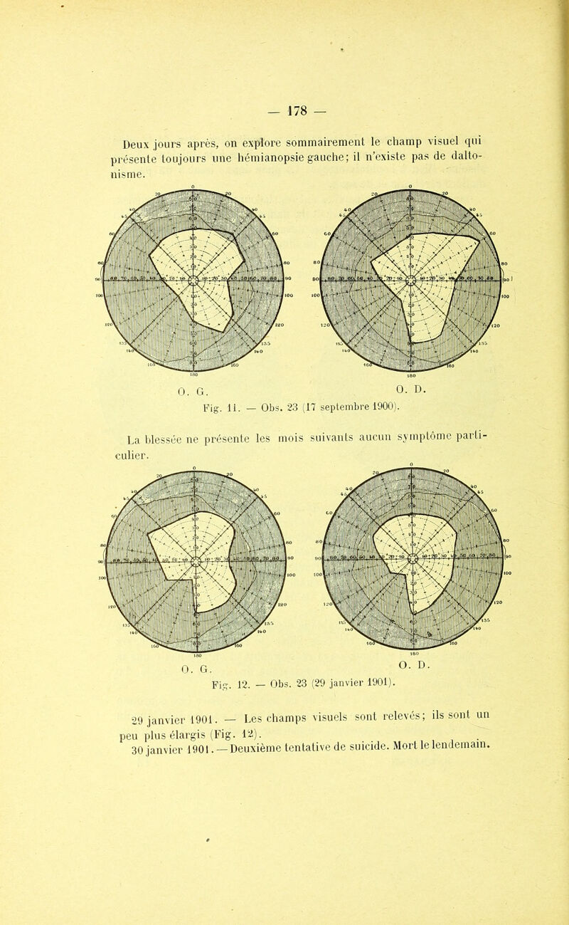 Deux jours après, on explore sommairement le champ visuel qui présente toujours une hémianopsie gauche; il n’existe pas de dalto- nisme. O. G. O. D. Fig. 11. — Obs. 2.3 (17 septembre 1900). La Idessée ne présente les mois suivants aucun symptôme parti- culier. O. G. Fig. 12. — Obs. 23 (29 janvier 1901). 29 janvier 1901. — Les champs visuels sont relevés; ils sont un peu plus élargis (Fig. 12). 30 janvier 1901.— Deuxième tentative de suicide. Mort le lendemain.