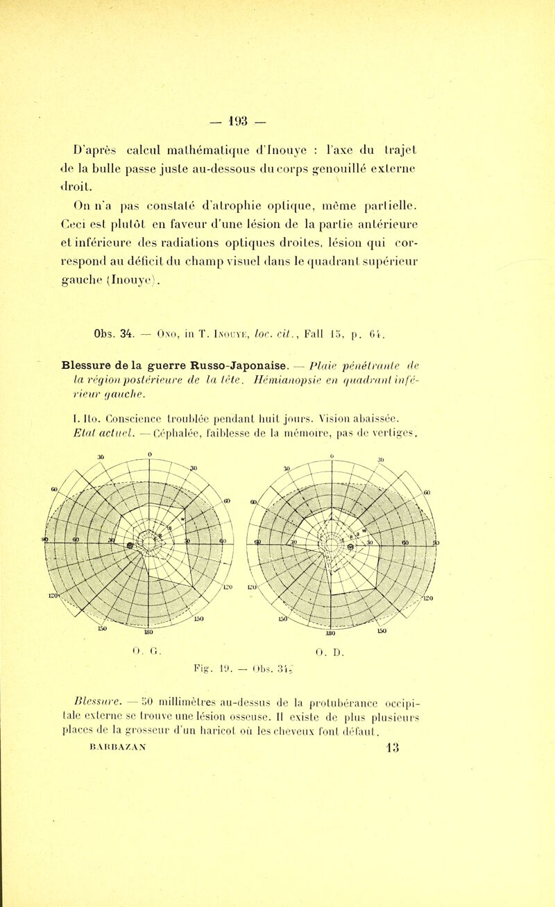 D’après calcul malhémalique d’Iiiouye : l’axe du Irajet <1e la bulle passe juste au-dessous du corps genouillé exlerue <lroil. On n'a |)as cousLalé d’alrophte optique, même parlielle. Ceci est plutôt en faveur d’une lésion de la partie antérieure et inférieure des radiations optiques droites, lésion qui cor- respond au déficit du champ visuel dans le quadrant supérieur gauche (Inouyc !. Ohs. 34. — O.No, ia T. I.nocvi;, loc. cil., Fall 1.C p. OC Blessure de la guerre Russo-Japonaise. — Plaie péaétranle de la région postérieure de la tète. Hémianopsie en (inadr/nd infé- rieur gauche. I. Ilo. Conscience troublée pendant Imit jours. Vision abaissée. Etal actuel. —Céphalée, iaildesse de la mémoire, pas de vertiges. Blessure. — 50 millimètres au-dessus de la pi'olubérancc occipi- tale e.xtcrne se trouve une lésion osseuse. Il existe de plus plusieurs places de la grosseur d'un haricot où les cheveux l’ont déraul. n.utn.\/A.\ 13