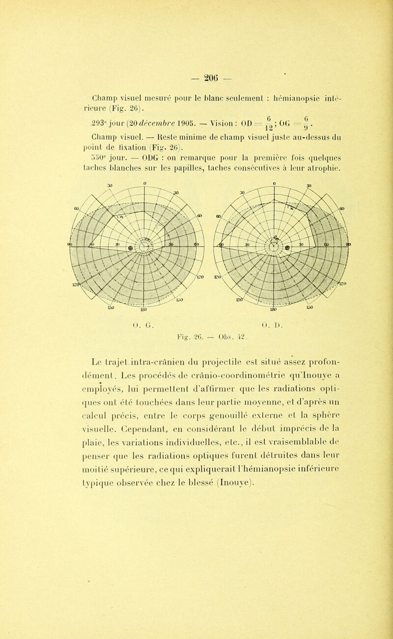 Cliamp visuel mesuré pour le blanc seulement : hémianopsie inté- rieure (b'’ig. 26). 293'--jour {20 décembre 1905. — Vision : OD = ; OG — ^ . Champ visuel. — Reste minime de champ visuel juste au-dessus du point de lixation (Fig. 26). 550“ jour. — ODG : on remarque pour la première lois quelques taches blanches sur les papilles, taches consécutives à leur atrophie. O. G. n. D. Fig. 26. - Obs. .12. Le trajet.intra-cràiiien du projeclile est situé assez prol'on- déinenl. Les procédés de cràiiio-coordinoméirie qu’Iiiouye a employés, lui {)ermetteut d’ariirmer que les radiations opti- (jues ont élé louchées dans leur partie moyenne, et d’après un calcul précis, entre le corps g-enouillé externe et la sphère visuelle. Cependant, en considérant le début imprécis de la plaie, les variations individuelles, etc., il est vraisemblable de penser que les radiations optiques furent détruites dans leur moilié supérieure, ce qui expliquerait l’hémianopsie inférieure typi(jue observée chez le blessé (Inouye).
