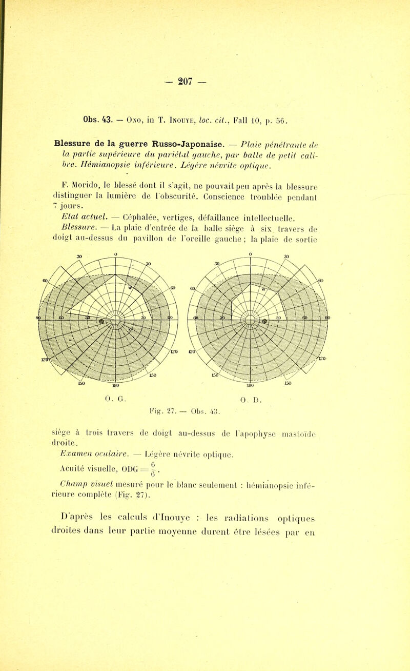 Obs. 43. — O.NO, iii T. Inouïe, loc. cil., Fall 10, p. 56. Blessure de la guerre Russo-Japonaise. — Plaie pénétrante de la partie supérieure du pariétal (jauche, par balle de petit cali- bre. Hémianopsie inférieure. Légère névrite optique. F. Moi'ido, le blessé dont il s’agit, ne pouvait peu après la blessure distinguer la lumière de l'obscurité. Conscience trouldée pendani 7 jours. Etat actuel. — Céphalée, vertiges, déraillance intellectuelle. Blessure. — La plaie d’entrée de la balle siège à six travers de doigt au-dessus du pavillon de l’oreille gauclie ; la plaie de sorlic O. G. O, D. Fig. 27. — Obs. -i.S. siège à trois Iravers de doigt au-dessus de l'apopbyse maslo'nle droite. Examen oculaire. — Légère névrite opti(iuc. Acuité visuelle, ÜDC — Champ visuel mesuré pour le blanc seulement ; hémianopsie infé- rieure complète (Fig. 27). D'après les calculs d’Inouye ; les radiations optiques droites dans leur partie raoyeime durent cMrc lésées i)ar eu