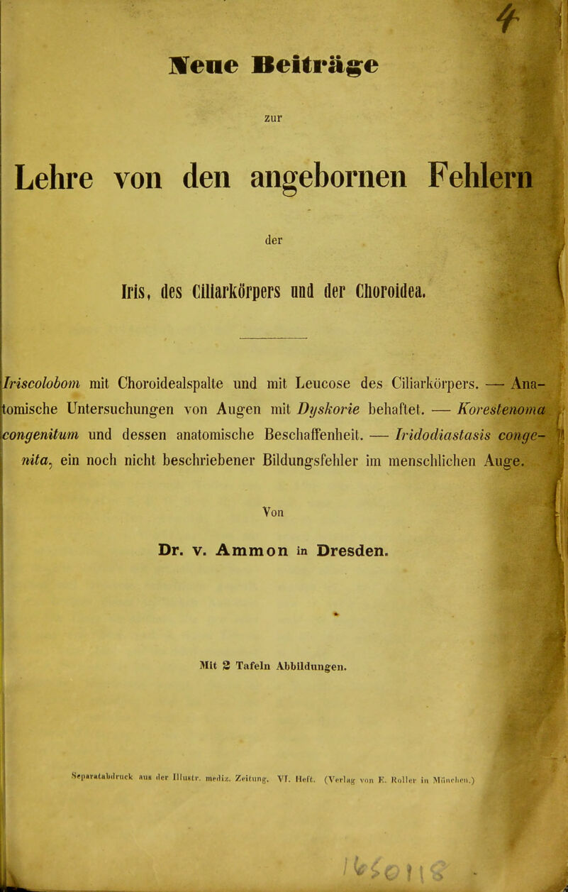 Mene Beiträg^e zur Lehre von den angebornen Fehlern der Iris, des Ciliarkörpers nad der Clioroidea. Iriscolobom mit Choroidealspalte und mit Leucose des Ciliarkörpers. — Ana- omische Untersuchung-en von Augen mit Dyskorie beliaftet. — Korestenoma congenitum und dessen anatomische Beschaffenheit. — Iridodiastasis conge- nita^ ein noch nicht beschriebener Bildungsfehler im menschlichen Auge. Von Dr. V. Ammon m Dresden. Mit S Tafeln AbbUdimffen. .Sepai-atali.lruck aus der Illiulr. meiliz. Zrilung;. VT. HeFt. (Verlag ynn K. Uollnr in Milnrhon.)