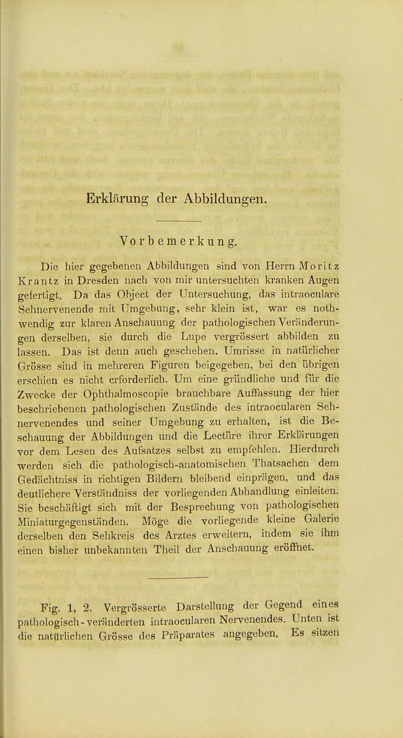 Erklärung der Abbildungen. Vorbemerkung. Die hier gegebenen Abbildungen sind von Herrn Moritz Krantz in Dresden nach von mir untersuchten kranken Augen gefertigt. Da das Object der Untersuchung, das intraoculare Sehnervenende mit Umgebung, sehr klein ist, war es noth- wendig zur klaren Anschauung der pathologischen Veränderun- gen derselben, sie durch die Lupe vergrössert abbilden zu lassen. Das ist denn auch geschehen. Umrisse in natürlicher Grösse sind in mehreren Figuren beigegeben, bei den übrigen erschien es nicht erforderlich. Um eine gründliche und für die Zwecke der Ophthalmoscopie brauchbare AuiFassung der hier beschriebenen pathologischen Zustände des intraocularen Seh- nervenendes und seiner Umgebung zu erhalten, ist die Be- schauung der Abbildungen und die Leetüre ihrer Erklärungen vor dem Lesen des Aufsatzes selbst zu empfehlen. Hierdurch werden sich die pathologisch-anatomischen Thatsachcn dem Gedächtniss in richtigen Bildern bleibend einprägen, und das deutlichere Verständniss der vorliegenden Abhandlung einleiten. Sie beschäftigt sich mit der Besprechung von pathologischen Miniaturgegenständen. Möge die vorliegende kleine Galerie derselben den Sehkreis des Arztes erweitern, indem sie ihm einen bisher unbekannten Theil der Anschauung eröffnet. Fig. 1, 2. Vergrösserte Darstellung der Gegend eines pathologisch-veränderten intraocularen Nervenendes. Unten ist die natürlichen Grösse des Präparates angegeben. Es sitzen