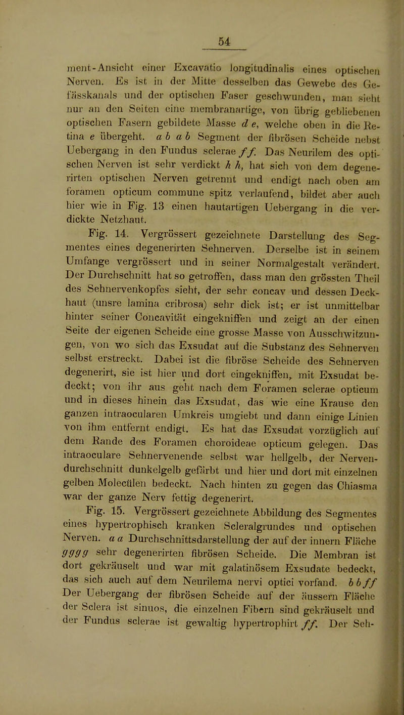 inejit-Ansicht einer Excavatio Jongitudinalis eines optisclieii Nerven. Es ist in der Mitte desselben das Gewebe des Ge- fässkanals und der optischen Faser geschwunden, man sieht nur an den Seiten eine niembranartige, von übrig gebliebenen optischen Fasern gebildete Masse d e, welche oben in die Ke- tina e übergeht, a b ab Segment der fibrösen Scheide iKiijst Uebergang in den Fundus sclerae // Das Neurilem des opti- schen Nerven ist sehr verdickt h h, hat sich von dem degene- rirten optischen Nerven getrennt und endigt nach oben am foramen opticum commune spitz verlaufend, bildet aber auch hier wie in Fig. 13 einen hautartigen Uebergang in die ver- dickte Netzhaut. Fig. 14. Vergrössert gezeichnete Darstellung des Seg- mentes eines degenerirten Sehnerven. Derselbe ist in seinem Umfange vergrössert und in seiner Normalgestalt verändert. Der Durchschnitt hat so getroffeii, dass man den grössten Theil des Sehuervenkopfes sieht, der sehr concav und dessen Deck- haut (unsre lamina cribrosa) sehr dick ist; er ist unmittelbar hinter seiner Concavität eingekniffen und zeigt an der einen Seite der eigenen Scheide eine grosse Masse von Ausschwitzun- gen, von wo sich das Exsudat auf die Substanz des Sehnerven selbst erstreckt. Dabei ist die fibröse Scheide des Sehnerven degenerirt, sie ist hier und dort cingekniffen, mit Exsudat be- deckt; von ihr aus geht nach dem Foramen sclerae opticum und in dieses hinein das Exsudat, das wie eine Krause den ganzen intraocularen Umkreis umgiebt und dann einige Linien von ihm entfernt endigt. Es hat das Exsudat vorzüglich auf dem Eande des Foramen choroideae opticum gelegen. Das intraoculare Sehnervenende selbst war hellgelb, der Nerveu- durchschnitt dunkelgelb gefärbt und hier und dort mit einzelnen gelben Molecülen bedeckt. Nach hinten zu gegen das Chiasma war der ganze Nerv fettig degenerirt. Fig. 15. Vergrössert gezeichnete Abbildung des Segmentes eines hypertrophisch kranken Scleralgrundes und optischen Nerven, a a Durchschnittsdarstellung der auf der innern Fläche gggg sehr degenerirten fibrösen Scheide. Die Membran ist dort gekräuselt und war mit galatinösem Exsudate bedeckt, das sich auch auf dem Neurilema nervi optici vorfand, bbff Der Uebergang der fibrösen Scheide auf der äussern Fläche der Sclera ist sinuos, die einzelnen Fibern sind gekräuselt und der Fundus sclerae ist gewaltig hypertrophirt //. Der Seil-