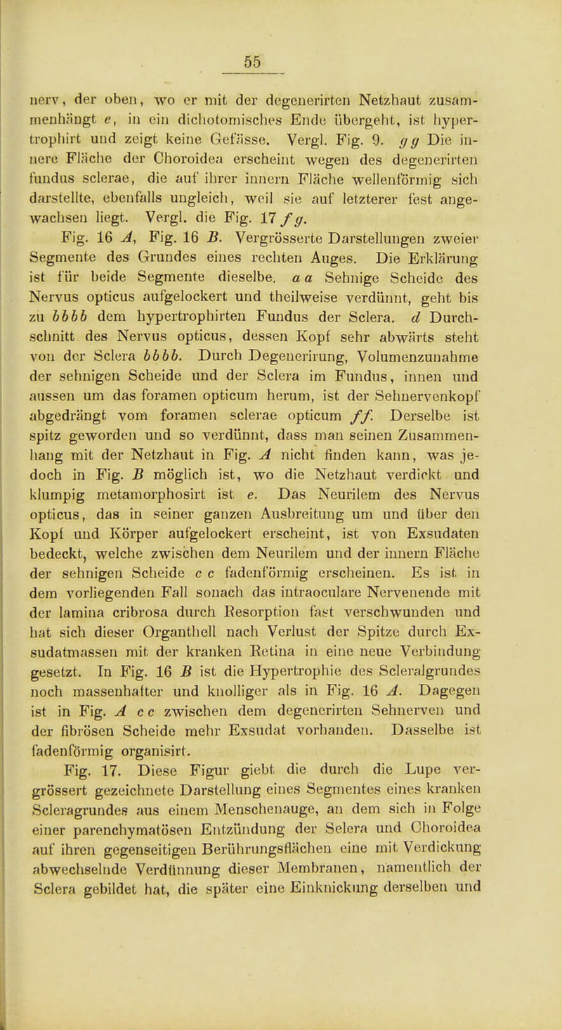 _55_ nerv, der oben, wo er mit der degenerirten Netzhaut zusam- menhängt e, in ein dichotomisches Ende übei'geht, ist hyper- trophirt und zeigt keine Gefiisse. Vergl. Fig. 9. gg Die in- nere Fläche der Choroidea erscheint wegen des degenerirten fundiis sclerae, die auf ilirer innern Fläche wellenförmig sich darstellte, ebenfalls ungleich, weil sie auf letzterer fest ange- wachsen liegt. Vergl. die Fig. 17 f g. Fig. 16 A, Fig. 16 B. Vergrösserte Darstellungen zweier Segmente des Grundes eines rechten Auges. Die Erklärung ist für beide Segmente dieselbe, a a Sehnige Scheide des Nervus opticus aufgelockert und theilweise verdünnt, geht bis zu bbbb dem hypertrophirten Fundus der Sclera. d Durch- schnitt des Nervus opticus, dessen Kopf sehr abwärts steht von der Sclera bbbb. Durch Degenerirung, Volumenzunahme der sehnigen Scheide und der Sclera im Fundus, innen und aussen um das foramen opticum herum, ist der Sehnervenkopf abgedrängt vom foramen sclerae opticum // Derselbe ist spitz geworden und so verdünnt, dass man seinen Zusammen- hang mit der Netzhaut in Fig. A nicht finden kann, was je- doch in Fig. B möglich ist, wo die Netzhaut verdickt und klumpig metamorphosirt ist e. Das Neurilem des Nervus opticus, das in seiner ganzen Ausbreitung um und über den Kopf und Körper aufgelockert erscheint, ist von Exsudaten bedeckt, welche zwischen dem Neurilem und der innern Fläche der sehnigen Scheide c c fadenförmig erscheinen. Es ist in dem vorliegenden Fall sonach das intraoculare Nervenende mit der lamina cribrosa durch Kesorption fast A^erschwunden und hat sich dieser Organthell nach Verlust der Spitze durch Ex- sudatmassen mit der kranken Retina in eine neue Verbindung- gesetzt. In Fig. 16 B ist die Hypertrophie des Scleralgrundes noch massenhafter und knolliger als in Fig. 16 A. Dagegen ist in Fig. A cc zwischen dem degenerirten Sehnerven und der fibrösen Scheide mehr Exsudat vorhanden. Dasselbe ist fadenförmig organisirt. Fig. 17. Diese Figur giebt die durch die Lupe ver- gi'össert gezeichnete Darstellung eines Segmentes eines kranken Scleragrunde.? aus einem Menschenauge, an dem sich in Folge einer parenchymatösen Entzündung der Selera und Choroidea auf ihren gegenseitigen Berührungsflächen eine mit Verdickung abwechselnde Verdtinnung dieser Membranen, namentlich der Sclera gebildet hat, die später eine Einknickiing derselben und