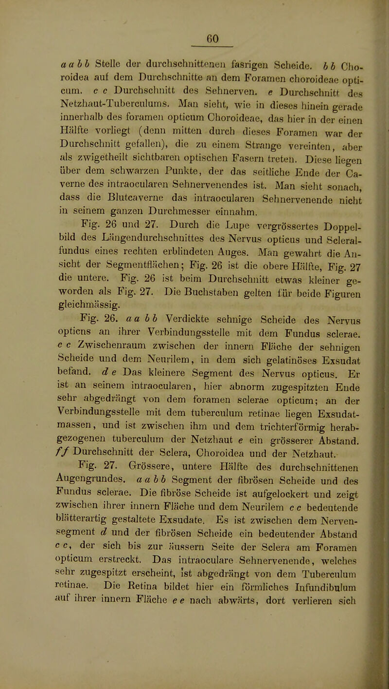 aabb Stelle der durclischnittpneii fasrigen Scheide, b b Cho- roidea auf dem Durchschnitte an dem Foramen choroideae opti- cum. c c Durchschnitt des Sehnerven, e Durchschnitt des Netzliaut-Tuberculums. Man sieht, wie in dieses hinein gerade innerhalb des forameii opticum Choroideae, das hier in der einen Hälfte vorliegt (denn mitten durch dieses Foramen war der Durchschnitt gefallen), die zu einem Strange vereinten, aber als zwigetheilt sichtbaren optischen Fasern treten. Diese liegen über dem schwarzen Punkte, der das seitliche Ende der Ca- verne des intraocularen Sehnervenendes ist. Man sieht sonach, dass die Blutcaverne das intraocularen Sehnervenende nicht in seinem ganzen Durchmesser einnahm. Fig. 26 und 27. Durch die Lupe vergrössertes Doppel- bild des Längendurchschuittes des Nervus opticus und Scleral- f'undus eines rechten erblindeten Auges. Man gewahrt die An- sicht der Segmentflächen; Fig. 26 ist die obere Hälfte, Fig. 27 die untere. Fig. 26 ist beim Durchschnitt etwas kleiner ge- worden als Fig. 27. Die Buchstaben gelten für beide Figuren gleichmässig. Fig. 26. aabb Verdickte sehnige Scheide des Nervus opticns an ihrer Verbindungsstelle mit dem Fundus sclerae. c c Zwischenraum zwischen der innern Fläche der sehnigen Scheide und dem Neurilem, in dem sich gelatinöses Exsudat befand, d e Das kleinere Segment des Nervus opticus. Er ist an seinem intraocularen, hier abnorm zugespitzten Ende sehr abgedrängt von dem forameu sclerae opticum; an der Verbindungsstelle mit dem tuberculum retinae liegen Exsudat- massen, und ist zwischen ihm und dem trichterförmig herab- gezogenen tuberculum der Netzhaut e ein grösserer Abstand. // Durchschnitt der Sclera, Choroidea und der Netzhaut. Fig. 27. Grössere, untere Hälfte des durchschnittenen Augengrundes, aabb Segment der fibrösen Scheide und des Fundus sclerae. Die fibröse Scheide ist aufgelockert und zeigt zwischen ihrer iimern Fläche und dem Neurilem c c bedeutende blätterartig gestaltete Exsudate. Es ist zwischen dem Nerven- .segment d und der fibrösen Scheide ein bedeutender Abstand c c, der sich bis zur äussern Seite der Sclera am Foramen opticum erstreckt. Das intraoculare Sehnervenende, welches sehr zugespitzt erscheint, Ist abgedrängt von dem Tuberculum retinae. Die Retina bildet hier ein förmliches Infundibulum auf ihrer innern Fläche ee nach abwärts, dort verlieren sich