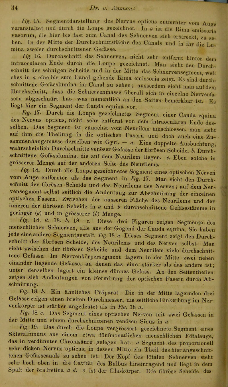 Fig. 15. ScgniontdiirstoUuiif? dea Nervus opticus entfernter vom Auge veranstaltet und durch die Loupc gezeichnet. In a ist die Rinia emissoria VHsorum, die hier bis fast zum Canal des Sehnerven sich erstreckt, zu se- hen. In der Mitte der Durclischnittsfläche des Canals und in ihr die Lu naina zweier dui'chschnittener Gefasse. Fig. 16. Durchschnitt des Sehnerven, nicht sehr entfernt hinter dem intraocularen Ende durch die Loupe gezeichnet. Man sieht den Durch- schnitt der sehnigen Scheide und in der Mitte das Sehnervensegment wel- ches in a eine bis zum Canal gehende Rima emissoria zeigt. Es sind durch- schnittene Gefässlumina im Canal zu sehen; ausserdem sieht man auf dem Durchschnitt, dass die Sehnervenmasse fiberall sich in einzelne Nervenfa- sern abgeschnürt hat, was namentlich an den Seiten bemerkbar ist. Es liegt hier ein Segment der Cauda equina vor. Fig. 17. Durch die Loupe gezeichnetes Segment einer Cauda equina des Nervus opticus, nicht sehr entfernt von dem intraocularen Ende des- selben. Das Segment ist zunächst vom Neurilem Umschlossen, man sieht auf ihm die Theilung in die optischen Fasern und doch auch eine Zu- • sammenhangsmasse derselben wie Gyri. - a. Eine doppelte Ausbuchtung, wahrscheinlich Durchschnitte venöser Gefässe der fibrösen Scheide, ö. Durch- schnittene Gefässlumina, die auf dem Neurilem liegen, c. Eben solche in grösserer Menge auf der anderen Seite des Neurilems. Fig. 18. Durch die Loupe gezeichnetes Segment eines optischen Nerven vom Auge entfernter als das Segment in Fig. 17. Man sieht den Durch- schnitt der fibrösen Scheide und des Neurilems des Nerven; auf dem Ner- vensegment selbst seitlich die Andeutung zur Abschnürung der einzelnen optischen Fasern. Zwischen der äusseren Fläche des Neurilems und der inneren der fibrösen Scheide in a und b durchschnittene Gefässstämme in geringer (a) und in grösserer (b) Menge. Fig. 18. a. 18. b, 18 c. Diese drei Figuren zeigen Segmente des menschlichen Sehnerven, alle aus der Gegend der Cauda equina. Sie haben jede eine andere Segmentgestalt. Fig. 18 a. Dieses Segment zeigt den Durch- schnitt der fibrösen Scheide, des Neurilems und des Nerven selbst. Man sieht zwischen der fibrösen Scheide und dem Neurilem viele durchschnit- tene Gefässe. Im Nervenkörpersegment lagern in der Mitte zwei neben einander liegende Gefässe, an denen das eine stärker als das andere ist; unter denselben lagert ein kleines dünnes Gefass. An den Seitentheilen zeigen sich Andeutungen von Formirung der optischen Fasern durch Ab- schnürung. Fig. 18. b. Ein ähnliches Präparat. Die in der Mitte lagernden drei Gefässe zeigen einen breiten Durchmesser, die seitliche Einkerbung im Ner- venkörper ist stärker angedeutet als in Fig. 18 ß. Fig. 18 c. Das Segment eines optischen Nerven mit zwei Gefässen in der Mitte und einem durchschnittenen venösen Sinus in a. Fig. 19. Das durch die Loupe vergrössert gezeichnete Segment eines Skleralfundus aus einem etwa fünfmonatlichen menschlichen Fötalauge, das in verdünnter Chromsäure gelegen hat. a Segment des proportioneil sehr dicken Nervus opticus, in dessen Mitte ein Theil des hier angeschnit- tenen Gefässcanals zu sehen ist. Der Kopf des fötalen Sehnerven steht sehr hoch oben in die Cavität des Bulbus hineinragend und liegt in dem Spalt der ötalretina d d. c ist der Glaskörper. Die fibröse Scheide des