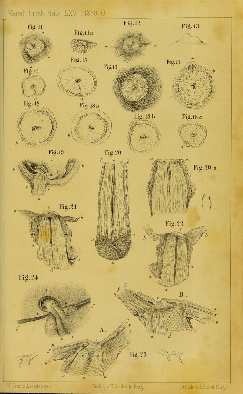 Vienelj. f.prak.Heirk. LXV. (4860.1) ■ Krantz ,üresden^e2. Verk)^ v. K.Andre in Prai,. Steini. v. J.Habel,Pra^,.
