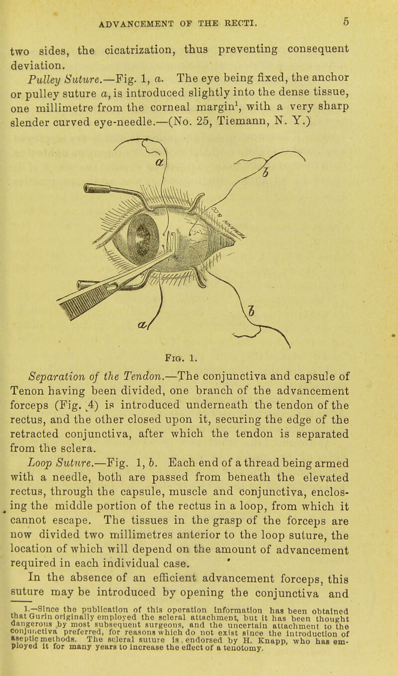 two sides, the cicatrization, thus preventing consequent deviation. Pulley Suture.—Fig. 1, a. The eye being fixed, the anchor or pulley suture a, is introduced slightly into the dense tissue, one millimetre from the corneal margin1, with a very sharp slender curved eye-needle.—(No. 25, Tiemann, N. Y.) Fig. 1. Separation of the Tendon.—The conjunctiva and capsule of Tenon having been divided, one branch of the advancement forceps (Fig. k4) is introduced underneath the tendon of the rectus, and the other closed upon it, securing the edge of the retracted conjunctiva, after which the tendon is separated from the sclera. Loop Suture.—Fig. 1, b. Each end of a thread being armed with a needle, both are passed from beneath the elevated rectus, through the capsule, muscle and conjunctiva, enclos-  ing the middle portion of the rectus in a loop, from which it cannot escape. The tissues in the grasp of the forceps are now divided two millimetres anterior to the loop suture, the location of which will depend on the amount of advancement required in each individual case.  In the absence of an efficient advancement forceps, this suture may be introduced by opening the conjunctiva and 1.—Since the publication of this operation Information has been obtained that Gurin originally employed the scleral attachment, but it has been thought dangerous by most subsequent surgeons, and the uncertain attachment to the conjunctiva preferred, for reasons which do not exist since the Introduction of aseptic methods. The scleral suture is . endorsed by H. Knapp, who has em- ployed it for many years to increase the effect of a tenotomy.