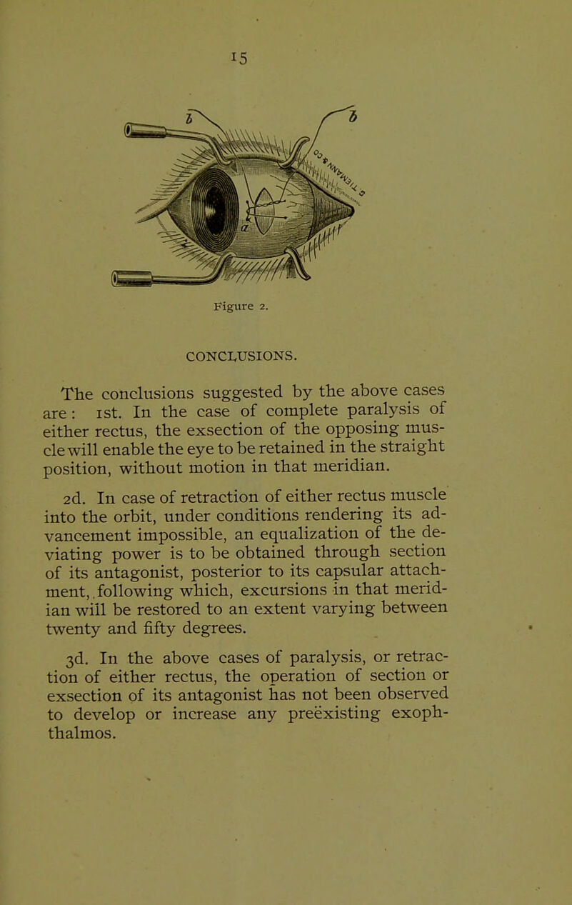 Figure 2. CONCI.USIONS. The conclusions suggested by the above cases are: ist. In the case of complete paralysis of either rectus, the exsection of the opposing mus- cle will enable the eye to be retained in the straight position, without motion in that meridian. 2d. In case of retraction of either rectus muscle into the orbit, under conditions rendering its ad- vancement impossible, an equalization of the de- viating power is to be obtained through section of its antagonist, posterior to its capsular attach- ment, . following which, excursions in that merid- ian will be restored to an extent varying between twenty and fifty degrees. 3d. In the above cases of paralysis, or retrac- tion of either rectus, the operation of section or exsection of its antagonist has not been obser\^ed to develop or increase any preexisting exoph- thalmos.