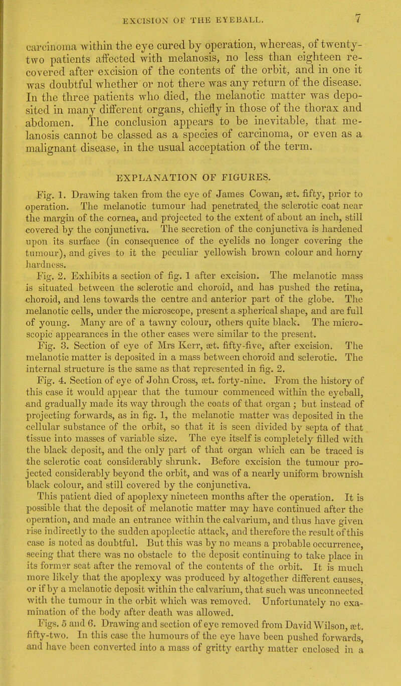 1 carcinoma within the eye cured by operation, whereas, of twenty- two patients affected with melanosis, no less than eighteen re- covered after excision of the contents of the orbit, and in one it was doubtful whether or not there was any return of the disease. In the three patients who died, the melanotic matter was depo- sited in many different organs, chiefly in those of the thorax and abdomen. The conclusion appears to be inevitable, that me- lanosis cannot be classed as a species of carcinoma, or even as a malignant disease, in the usual acceptation of the term. EXPLANATION OF FIGURES. Fig. 1. Drawing taken from tlie eye of James Cowan, set. fifty, prior to operation. The melanotic tumour Iiad penetrated tlie sclerotic coat near the margin of the cornea, and projected to the extent of about an inch, still covered by the conjunctiva. The secretion of the conjunctiva is hardened upon its surface (in consequence of the eyelids no longer covering the tumour), and gives to it the peculiar yellowish brown colour and horny liavdncss. Fig. 2. Exhibits a section of fig. 1 after excision. The melanotic mass is situated between the sclerotic and choroid, and has pushed the retina, choroid, and lens towards the centre and anterior part of the globe. Tlie melanotic cells, under the microscope, present a spherical shape, and are full of young. Many are of a tawny colour, others quite black. The micro- scopic appearances in the other cases were similar to the present. Fig. 3. Section of eye of Mrs Kerr, set. fifty-five, after excision. The melanotic matter is deposited in a mass between choroid and sclerotic. The internal structure is the same as that represented in fig. 2. Fig. 4. Section of eye of John Cross, fet. forty-nine. From the liistory of this case it would appear tliat the tumour commenced within the eyeball, ■and gradually made its way through the coats of that organ ; but instead of projecting forwards, as in fig. 1, the melanotic matter was deposited in the cellular substance of the orl:)it, so that it is seen divided by septa of that tissue into masses of variable size. The eye itself is completely filled with the black deposit, and the only part of that organ which can be traced is the sclerotic coat considerably shrunk. Before excision the tumour pro- jected considerably beyond the orbit, and was of a nearly uniform brownish black colour, and still covered by the conjunctiva. This patient died of apoplexy nineteen months after the operation. It is possible that the deposit of melanotic matter may have continued after the operation, and made an entrance within the calvarium, and thus have given rise indirectly to the sudden apoplectic attack, and therefore the result of this case is noted as doubtful. But this was by no means a probable occurrence, seeing that there was no obstacle to the deposit continumg to take place in its former scat after the removal of the contents of the orbit. It is much more likely that the apoplexy was produced by altogether different causes, or if by a melanotic deposit within the calvarimn, that such was unconnected with the tumour in the orbit which was removed. Unfortunately no exa- mination of the body after death was allowed. Figs. 6 and 6. Drawing and section of eye removed from David Wilson, cet. fifty-two. In this case the humours of the eye have been pushed forwards, and have been converted into a mass of gritty earthy matter enclosed in a