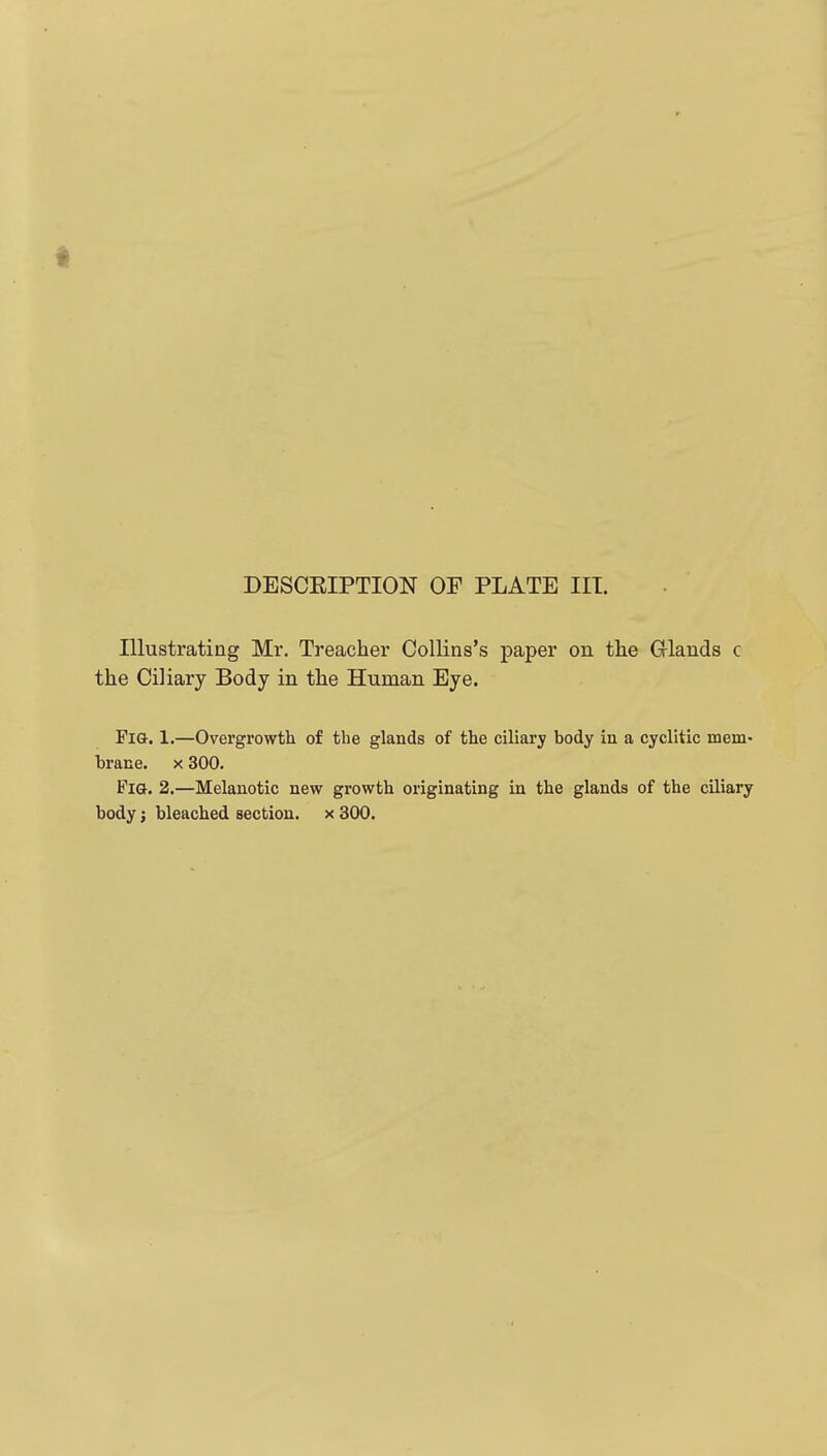 Illustrating Mr. Treacher CoUins's paper on the Grlands c the Ciliary Body in the Human Eye. Fia. 1,—Overgrowth of the glands of the ciliary body in a cyclitic mem- brane. X 300. Pig. 2.—Melanotic new growth originating in the glands of the ciliary body; bleached section, x 300.