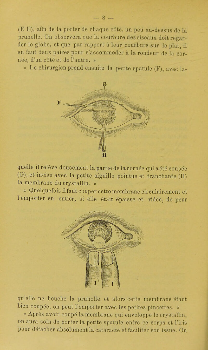 (E E), afin de la porter de chaque côté, un peu au-dessus de la prunelle. On observera que la courbure des ciseaux doit regar- der le globe, et que par rapport à leur courbure sur le plat, il en faut deux paires pour s'accommoder à la rondeur de la cor- née, d'un côté et de l'autre. » « Le chirurgien prend ensuite la petite spatule (F), avec la- G H quelle il relève doucement la partie de la cornée qui a été coupée (G), et incise avec la petite aiguille pointue et tranchante (H) la membrane du crystallin. » « Quelquefois il faut couper cette membrane circulairement et l'emporter en entier, si elle était épaisse et ridée, de peur qu'elle ne bouche la prunelle, et alors cette membrane étant bien coupée, on peut l'emporter avec les petites pincettes. » « Après avoir coupé la membrane qui enveloppe le crystallin, on aura soin de porter la petite spatule entre ce corps et l'iris pour détacher absolument la cataracte et faciliter son issue. On