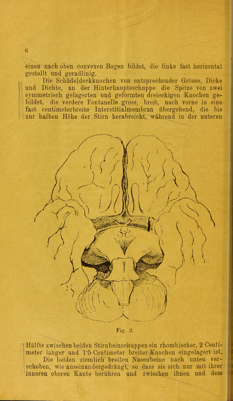 einen nach oben convexen Bogen bildet, die linke fast horizontal gestellt und geradlinig. Die Schädeldeckknochen von entsprechender Grösse, Dicke und Dichte, an der Hinterhauptsschnppe die Spitze von zwei symmetrisch gelagerten und geformten dreieckigen Knochen ge- bildet, die vordere Fontanelle gross, breit, nach vorne in eine fast centimeterbreite Interstitialmembran übergehend, die bis zur halben Höhe der Stirn herabreicht, während in der unteren Fig. 2. «Hälfte zwischen beiden Stirnbeinschuppenein rhombischer, 2 Centi- meter langer und 1'5 Centiraeter breiter Knochen eingelagert ist. Die beiden ziemlich breiten Nasenbeine nach unten ver- schoben, wie auseinandergedräugt, so dass sie sich nur mit ihrer inneren oberen Kante berühren und zwischen ihnen und dem