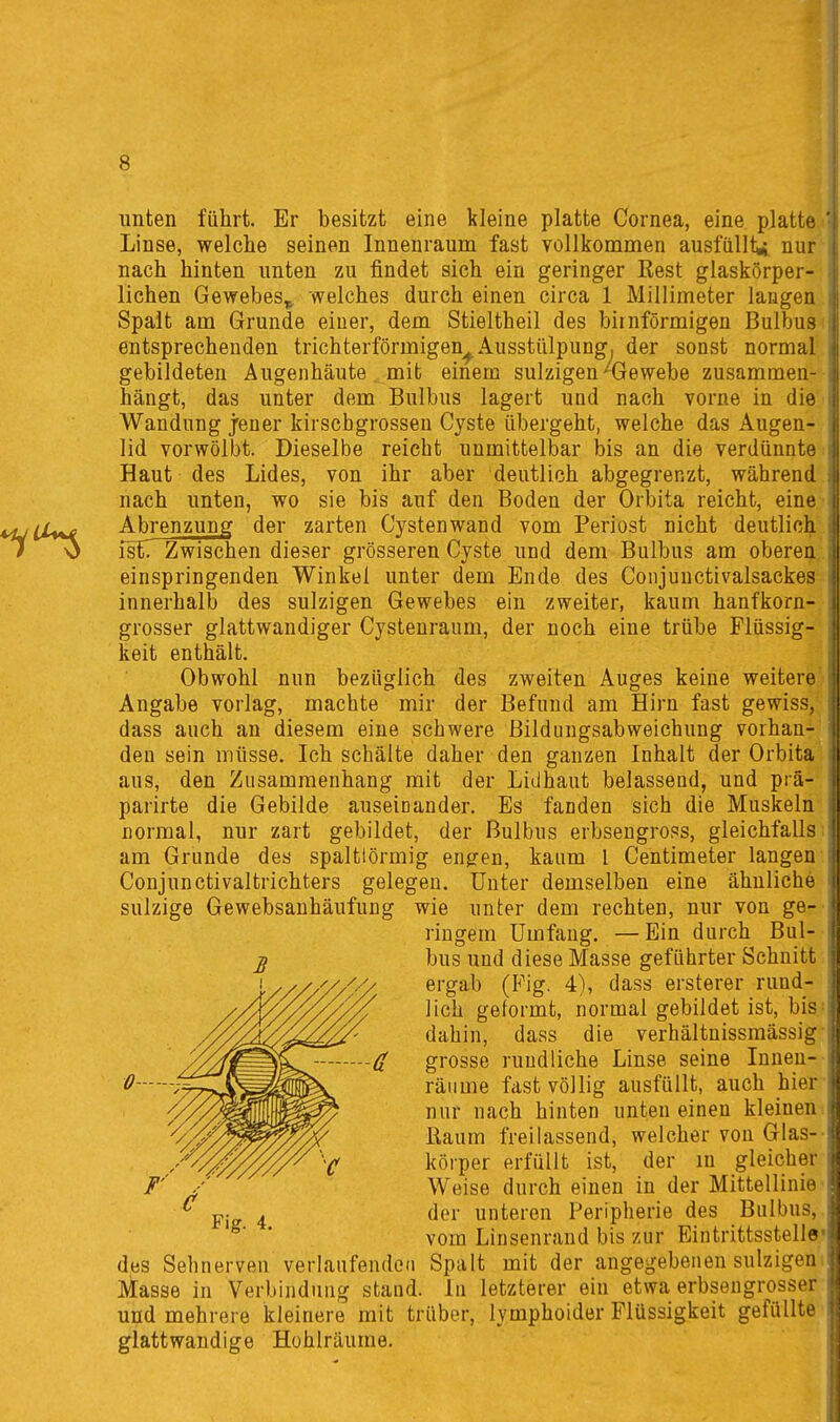 unten führt. Er besitzt eine kleine platte Cornea, eine platte Linse, welche seinen Innenraum fast vollkommen ausfiillii nur nach hinten unten zu findet sich ein geringer Rest glaskörper- lichen Gewebes^ welches durch einen circa 1 Millimeter langen Spalt am Grunde einer, dem Stieltheil des birnförmigen Bulbus entsprechenden trichterförmigen^ Ausstülpung^ der sonst normal gebildeten Augenhäute mit einem sulzigen Gewebe zusammen- hängt, das unter dem Bulbus lagert und nach vorne in die Wandung jener kirscbgrossen Cyste übergeht, welche das Augen- lid vorwölbt. Dieselbe reicht unmittelbar bis an die verdünnte Haut des Lides, von ihr aber deutlich abgegrenzt, während nach unten, wo sie bis auf den Boden der Orbita reicht, eine i Abrenzung der zarten Cystenwand vom Periost nicht deutlich isf. Zwischen dieser grösseren Cyste und dem Bulbus am oberen einspringenden Winkel unter dem Ende des Conjunctivalsackes I innerhalb des sulzigen Gewebes ein zweiter, kaum hanfkorn- grosser glattwandiger Cystenraum, der noch eine trübe Flüssig- keit enthält. Obwohl nun bezüglich des zweiten Auges keine weitere Angabe vorlag, machte mir der Befund am Hirn fast gewiss, dass auch an diesem eine schwere ßildiingsabweichung vorhan- den sein müsse. Ich schälte daher den ganzen Inhalt der Orbita aus, den Zusammenhang mit der Lidhaut belassend, und prä- parirte die Gebilde auseinander. Es fanden sich die Muskeln normal, nur zart gebildet, der Bulbus erbsengross, gleichfalls am Grunde des spalttörmig engen, kaum 1 Centimeter langen Conjunctivaltrichters gelegen. Unter demselben eine ähnliche sulzige Gewebsauhäufung wie unter dem rechten, nur von ge- ringem Umfang. —Ein durch Bul- ^ bus und diese Masse geführter Schnitt i//////^''/ ergab (Fig. 4), dass ersterer rund- lieh geformt, normal gebildet ist, bis /^^^^^^^ dahin, dass die verhältnissmässig yy^f^^^^^~--—ä grosse rundliche Linse seine Inneu- ^''77?J^M^^^ räume fast völlig ausfüllt, auch hier y//^^^^^^ nur nach hinten unten einen kleinen ///^^^^X Raum freilassend, welcher von Glas- '-'^^^^^^^V körper erfüllt ist, der m gleicher / Weise durch einen in der Mittellinie  p. 4 der unteren Peripherie des Bulbus, vom Linsenrand bis zur Eintrittsstelle des Sehnerven verlaufenden Spalt mit der angegebenen sulzigen Masse in Verbindung stand. In letzterer ein etwa erbsengrosser und mehrere kleinere mit trüber, lymphoider Flüssigkeit gefüllte glattwandige Hohlräume,