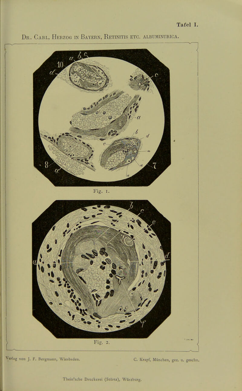 Dr. Carl, Herzog in Bayern, Retinitis etc. albuminurica. Verlag von J. F. Bergmann, Wiesbaden. C. Krapf, München, gez. u. gcsclin.