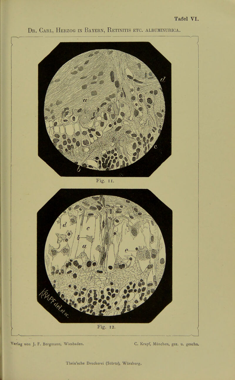 Dr. Carl, Herzog in Bayern, Retinitis etc. alruminurica. Verlag yon J. F. Bergmann, Wiesbaden. C. Krapf, München, gez. u. gcschn.