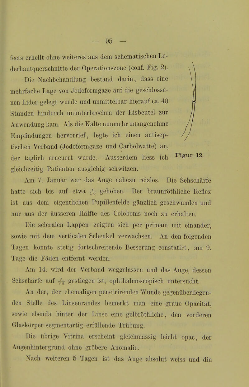 fects erhellt o-lme weiteres aus dem scheraatischen Le- derhautquerschnitte der Operationszone (conf. Fig. 2). Die Nachbehandlung bestand darin, dass eine mehrfache Lage von Jodoformgaze auf die geschlosse- ]j nen Lider gelegt wurde und unmittelbar hierauf ca. 40 Stunden hindurch ununterbrochen der Eisbeutel zur Anwendung kam. Als die Kälte nunmehr unangenehme Empfindungen hervorrief, legte ich einen antisep- tischen Verband (Jodoformgaze und Carbolwatte) an, der täglich erneuert wurde. Ausserdem Hess ich Fi£ur 12- gleichzeitig Patienten ausgiebig schwitzen. Am 7. Januar war das Auge nahezu reizlos. Die Sehschärfe hatte sich bis auf etwa ^ gehoben. Der braunröthliche Eeflex ist aus dem eigentlichen Pupillenfelde gänzlich geschwunden und nur aus der äusseren Hälfte des Coloboms noch zu erhalten. Die scleralen Lappen zeigten sich per primam mit einander, sowie mit dem verticalen Schenkel verwachsen. An den folgenden Tagen konnte stetig fortschreitende Besserung constatirt, am 9. Tage die Fäden entfernt werden. Am 14. wird der Verband weggelassen und das Auge, dessen Sehschärfe auf /T gestiegen ist, ophthalmoscopisch untersucht. An der, der ehemaligen penetrirenden Wunde gegenüberliegen- den Stelle des Linsenrandes bemerkt man eine graue Opacität, sowie ebenda hinter der Linse eine gelbröthliche, den vorderen Glaskörper segmentartig erfüllende Trübung. Die übrige Vitrina erscheint gleichmässig leicht opac, der Augenhintergrund ohne gröbere Anomalie. Nach weiteren 5 Tagen ist das Auge absolut weiss und die