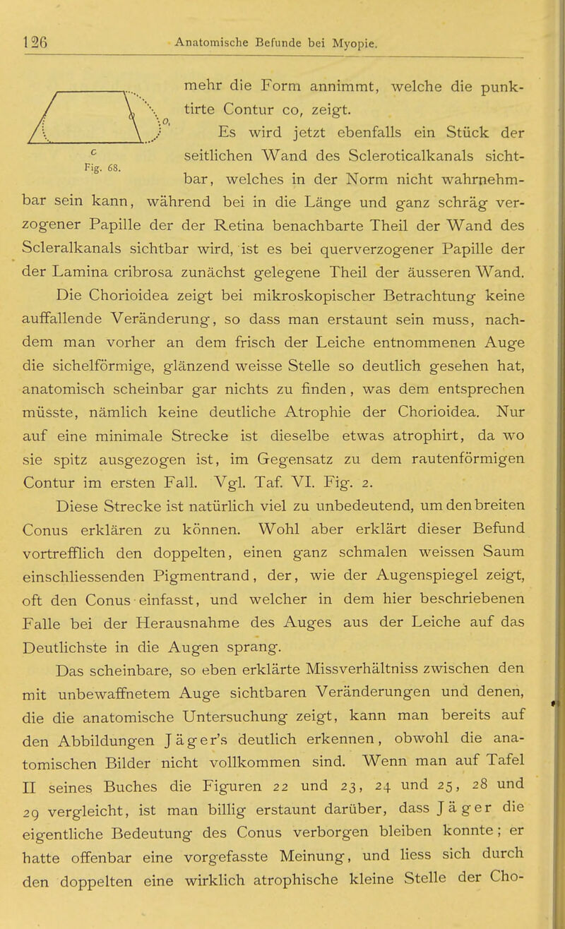 mehr die Form annimmt, welche die punk- V \ tirte Contur co, zeigt. \ / Es wird jetzt ebenfalls ein Stück der ^ seitlichen Wand des Scleroticalkanals sicht- Fig. 63. bar, welches in der Norm nicht wahrnehm- bar sein kann, während bei in die Länge und ganz schräg ver- zogener Papille der der Retina benachbarte Theil der Wand des Scleralkanals sichtbar wird, ist es bei querverzogener Papille der der Lamina cribrosa zunächst gelegene Theil der äusseren Wand. Die Chorioidea zeigt bei mikroskopischer Betrachtung keine auffallende Veränderung, so dass man erstaunt sein muss, nach- dem man vorher an dem frisch der Leiche entnommenen Auge die sichelförmige, glänzend weisse Stelle so deutlich gesehen hat, anatomisch scheinbar gar nichts zu finden, was dem entsprechen müsste, nämlich keine deutliche Atrophie der Chorioidea. Nur auf eine minimale Strecke ist dieselbe etwas atrophirt, da wo sie spitz ausgezogen ist, im Gegensatz zu dem rautenförmigen Contur im ersten Fall. Vgl. Taf. VI. Fig. 2. Diese Strecke ist natürlich viel zu unbedeutend, um den breiten Conus erklären zu können. Wohl aber erklärt dieser Befund vortrefflich den doppelten, einen ganz schmalen weissen Saum einschhessenden Pigmentrand, der, wie der Augenspiegel zeigt, oft den Conus einfasst, und welcher in dem hier beschriebenen Falle bei der Herausnahme des Auges aus der Leiche auf das Deutlichste in die Augen sprang. Das scheinbare, so eben erklärte Missverhältniss zwischen den mit unbewaffnetem Auge sichtbaren Veränderungen und denen, die die anatomische Untersuchung zeigt, kann man bereits auf den Abbildungen Jäger's deutlich erkennen, obwohl die ana- tomischen Bilder nicht vollkommen sind. Wenn man auf Tafel II seines Buches die Figuren 22 und 23, 24 und 25, 28 und 29 vergleicht, ist man billig erstaunt darüber, dass Jäger die eigentliche Bedeutung des Conus verborgen bleiben konnte; er hatte offenbar eine vorgefasste Meinung, und Hess sich durch den doppelten eine wirklich atrophische kleine Stelle der Cho-