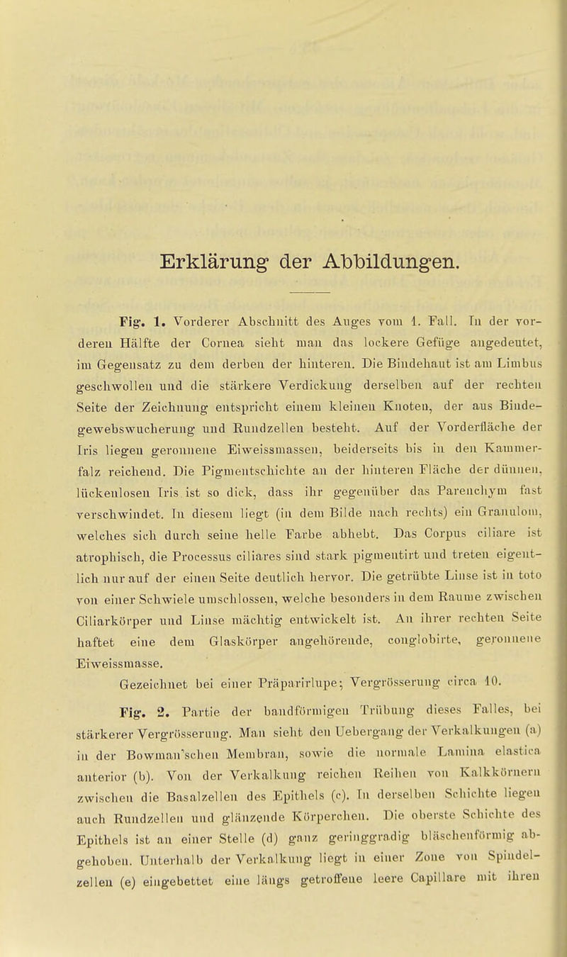 Erklärung der Abbildungen. Fig'. 1. Vorderer Abschnitt des Aiiges vom 1. Fall. Tu der yor- dereu Hälfte der Cornea sieht man das lockere Gefüge angedeutet, im Gegensatz zu dem derben der hinteren. Die Bindehaut ist am Liuibus geschwollen und die stärkere Verdickung derselben auf der rechten Seite der Zeichnung entspricht einem kleineu Knoteu, der aus Binde- gewebswucherung und Eundzellen besteht. Auf der Vorderfläche der Iris liegeu geronnene Eiweissmassen, beiderseits bis in den Kammer- falz reichend. Die Pigmentschichte an der hinteren Fläche der dünnen, lückenlosen Iris ist so dick, dass ihr gegenüber das Pareacliym fast verschwindet. In diesem Hegt (in dem Bilde nach rechts) ein Granulom, welches sich durch seine helle Farbe abhebt. Das Corpus ciliare ist atrophisch, die Processus ciliares sind stark pigmentirt und treten eigent- lich nur auf der einen Seite deutlich hervor. Die getrübte Linse ist in toto von einer Schwiele uiuschlossen, welche besonders in dem Räume zwischen Ciliarkörper und Linse mächtig entwickelt ist. An ihrer rechten Seite haftet eine dem Glaskörper angehörende, conglobirte, geronnene Eiweissmasse. Gezeichnet bei einer Präparirlupe-, Vergrösserung circa 10. Tig. 2. Partie der bandförmigen Trübung dieses Falles, bei stärkerer Vergrösserung. Man sieht den Uebergang der Verkalkungen (a) in der Bowman'schen Membran, sowie die normale Lamiua elastica anterior (b). Von der Verkalkung reichen Reihen von Kalkkörnern zwischen die Basalzellen des Epithels (c). Tu derselben Schichte liegen auch Rundzellen und glänzende Körperchen. Die oberste Schichte des Epithels ist an einer Stelle (d) ganz geringgradig bläschenförmig ab- gehoben. Unterhalb der Verkalkung liegt in einer Zone von Spindel- zelleu (e) eingebettet eine längs getroffene leere Capillare mit ihren