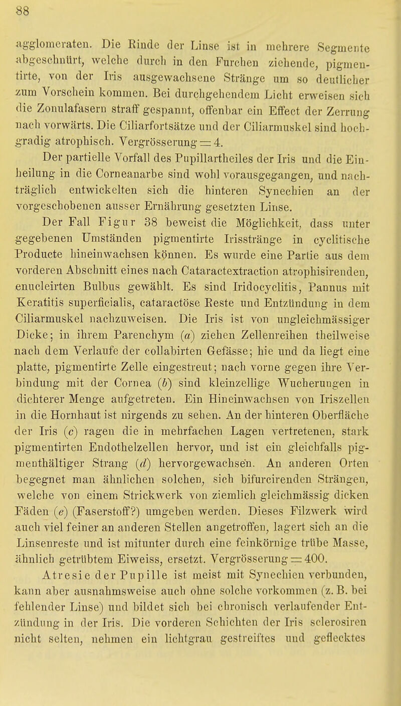 aygloraerateu. Die Rinde der Linse ist in mehrere Segmente abgeschnürt, welche durch in den Furchen ziehende, pigmen- tirte, von der Iris ausgewachsene Stränge um so deutlicher zum Vorschein kommen. Bei durchgehendem Licht erweisen sieh die Zonulafasern straff gespannt, offenbar ein Effect der Zerrung nach vorwärts. Die Ciliarfortsätze und der Ciliarmuskel sind hoch- gradig atrophisch. Vergrösserung = 4. Der partielle Vorfall des Piipillartheiles der Ms und die Ein- heilung in die Corneanarbe sind wohl vorausgegangen, und nach- träglich entwickelten sich die hinteren Synechien an der vorgeschobenen ausser Ernährung gesetzten Linse. Der Fall Figur 38 beweist die Möglichkeit, dass unter gegebenen Umständen pigraentirte Irisstränge in cyclitische Producte hineinwachsen können. Es wurde eine Partie aus dem vorderen Abschnitt eines nach Cataractextraction atrophisirenden, enucleirten Bulbus gewählt. Es sind Iridocyclitis, Pannus mit Keratitis superficialis, cataractöse Eeste und Entzündung in dem Ciliarmuskel nachzuweisen. Die Iris ist von ungleichmässiger Dicke; in ihrem Parenchym (a) ziehen Zellenreihen theilweise nach dem Verlaufe der collabirten Gefässe; hie und da liegt eine platte, pigmentirte Zelle eingestreut; nach vorne gegen ihre Ver- bindung mit der Cornea (b) sind kleinzellige Wucherungen in dichterer Menge aufgetreten. Ein Hineinwachsen von Iriszellen in die Hornhaut ist nirgends zu sehen. An der hinteren Oberfläche der Iris (c) ragen die in mehrfachen Lagen vertretenen, stark pigmentirten Endothelzellen hervor, und ist ein gleichfalls pig- menthältiger Strang [d) hervorgewachsen. An anderen Orten begegnet man ähnlichen solchen, sich bifurcirenden Strängen, welche von einem Strickwerk von ziemlich gleichmässig dicken Fäden (<?) (Faserstoff?) umgeben werden. Dieses Filzwerk wird auch viel feiner an anderen Stellen angetroffen, lagert sich an die Linsenreste und ist mitunter durch eine feinkörnige trübe Masse, ähnlich getrübtem Eiweiss, ersetzt. Vergrösserung = 400. Atresie der Pupille ist meist mit Synechien verbunden, kann aber ausnahmsweise auch ohne solche vorkommen (z. B. bei fehlender Linse) und bildet sich bei chronisch verlaufender Ent- zündung in der Iris. Die vorderen Schichten der Iris sclerosiren nicht selten, nehmen ein lichtgrau gestreiftes uud geflecktes