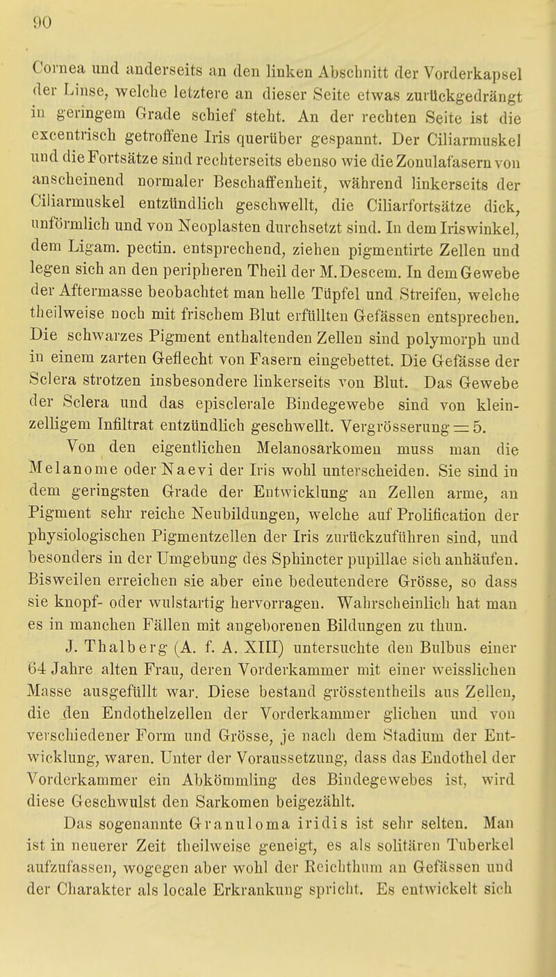 Cornea und tmderseits an den linken Abschnitt der Vorderkapsel der Linse, welche letztere an dieser Seite etwas zurückgedrängt in geringem Grade schief steht. An der rechten Seite ist die excentrisch getroffene Iris querüber gespannt. Der Ciliarmuskel und die Fortsätze sind rechterseits ebenso wie dieZonulafasernvon anscheinend normaler Beschaffenheit, während linkerseits der Ciliarmuskel entzündlich geschwellt, die Ciliarfortsätze dick, unförmlich und von Neoplasten durchsetzt sind. In dem Iiiswinkel, dem Ligam. pectin. entsprechend, ziehen pigmentirte Zellen und legen sich an den peripheren Theil der M.Descem. In dem Gewebe der Aftermasse beobachtet man helle Tüpfel und Streifen, welche theilweise noch mit frischem Blut erfüllten Gefässen entsprechen. Die schwarzes Pigment enthaltenden Zellen sind polymorph und in einem zarten Geflecht von Fasern eingebettet. Die Gefässe der Sclera strotzen insbesondere linkerseits von Blut. Das Gewebe der Sclera und das episclerale Bindegewebe sind von klein- zelligem Infiltrat entzündlich geschwellt. Vergrösserung=: 5. Von den eigentlichen Melanosarkomen muss man die Melanome oder Naevi der Iris wohl unterscheiden. Sie sind in dem geringsten Grade der Entwicklung an Zellen arme, an Pigment sehr reiche Neubildungen, welche auf Prolification der physiologischen Pigmentzellen der Iris zurückzuführen sind, und besonders in der Umgebung des Sphincter pupillae sich anhäufen. Bisweilen erreichen sie aber eine bedeutendere Grösse, so dass sie knöpf- oder wulstartig hervorragen. Wahrscheinlich hat mau es in manchen Fällen mit angeborenen Bildungen zu thun. J. Thalberg (A. f. A. XIII) untersuchte den Bulbus einer 64 Jahre alten Frau, deren Vorderkammer mit einer weisslichen Masse ausgefüllt war. Diese bestand grösstentheils aus Zellen, die den Endothelzellen der Vorderkammer glichen und von verschiedener Form und Grösse, je nach dem Stadium der Ent- wicklung, waren. Unter der Voraussetzung, dass das Endothel der Vorderkammer ein Abkömmling des Bindegewebes ist, wird diese Geschwulst den Sarkomen beigezählt. Das sogenannte Granuloma iridis ist sehr selten. Man ist in neuerer Zeit theilweise geneigt, es als solitären Tuberkel aufzufassen, wogegen aber wohl der Reichthum an Gefässen und der Charakter als locale Erkrankung spricht. Es entwickelt sich
