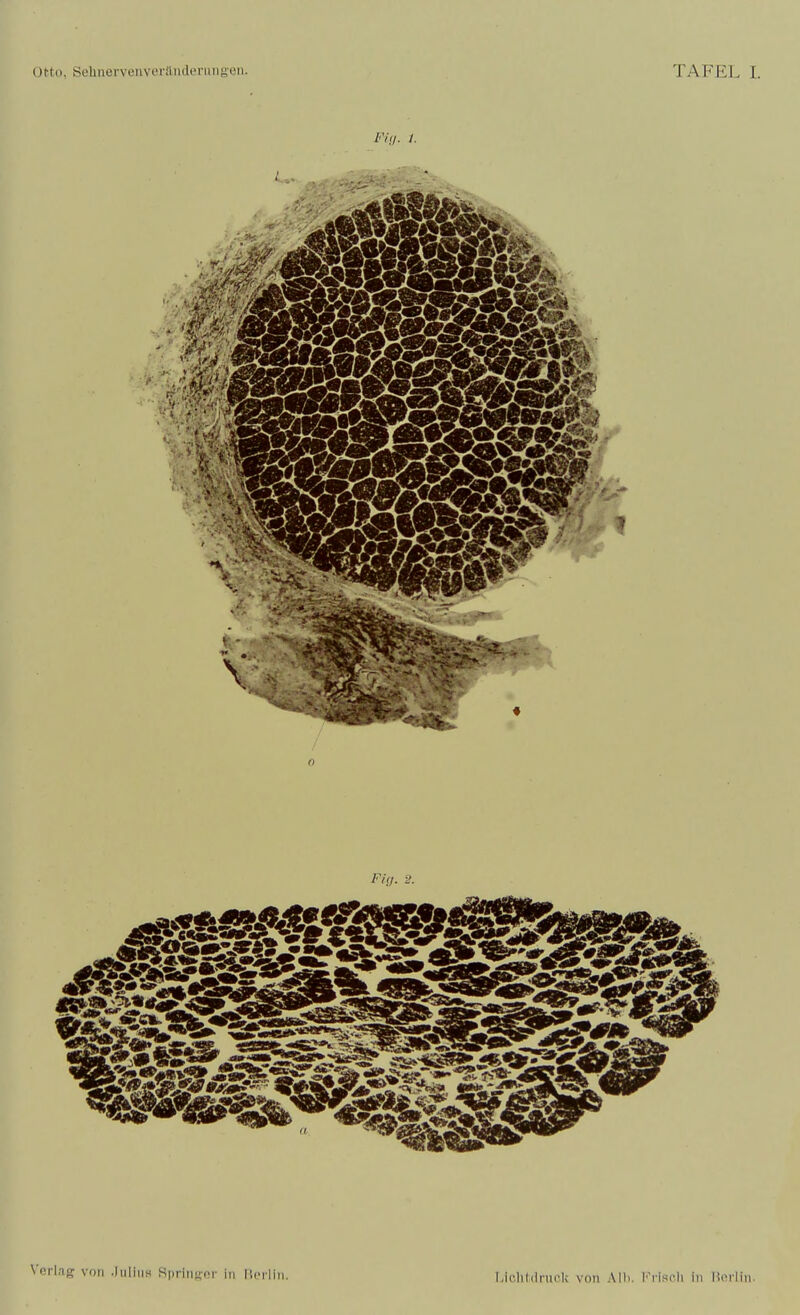 Fiil- /• / Fi<l. 2. Verlag von .liiliuH SpriiiKnr in lii-i liii. Lieh 1(1 nicli von Alb. Im-IscIi in llci-liii.