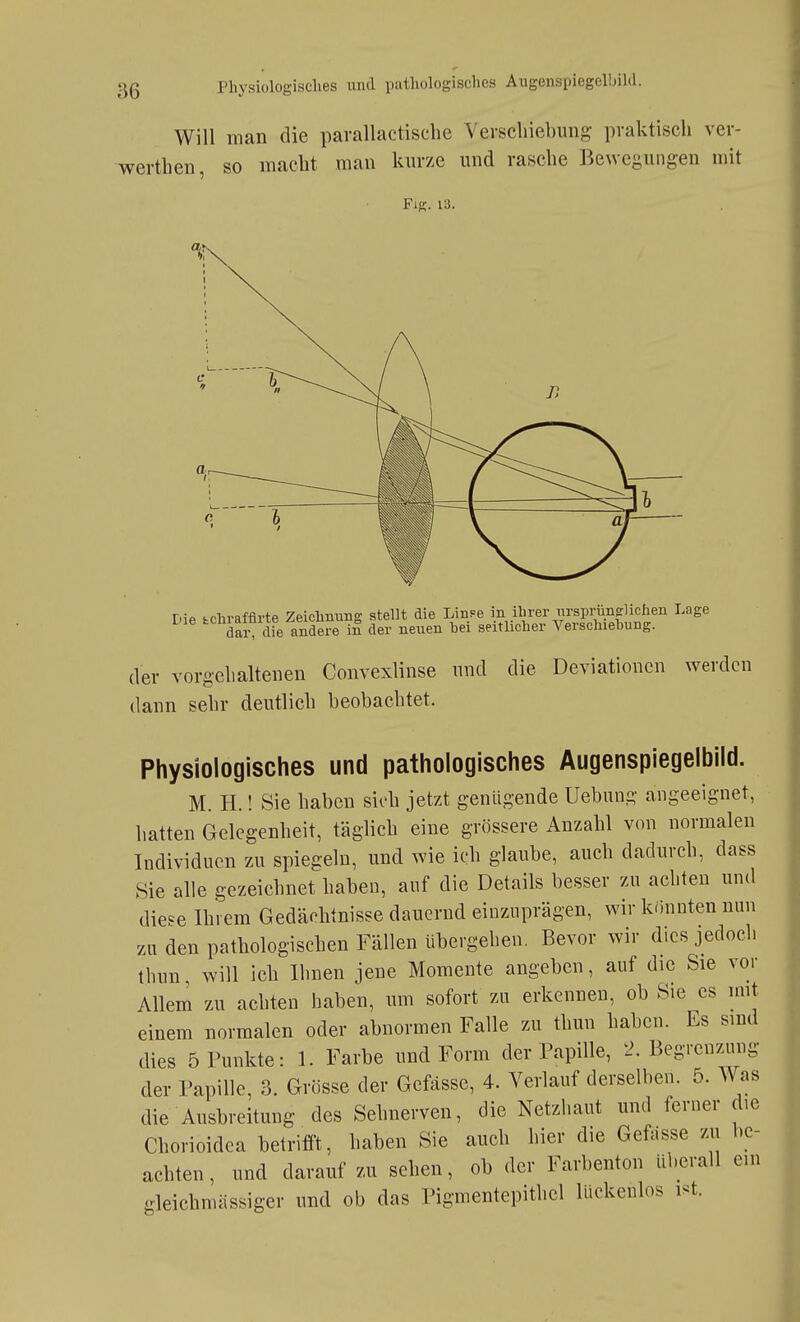 Will man die pavallactische Verschiebung praktisch ver- werthen, so macht man kurze und rasche Bewegungen mit FiK. 13. Die fcchrafflrte Zeichnung stellt die LinFe in ihrer virsprünfflichen Lage dai-^ die andere m der neuen bei seitlicher Verschiehung. der vorgehaltenen Convexlinse und dann sehr deutlich beobachtet. die Deviationen werden Physiologisches und pathologisches Augenspiegeibild. M. H.! Sie haben sioh jetzt genügende Uebung angeeignet, hatten Gelegenheit, täglich eine grössere Anzahl von normalen Individuen zu spiegeln, und wie ich glaube, auch dadurch, dass Sie alle gezeichnet haben, auf die Details besser zu achten und diese Ihrem Gedächtnisse dauernd einzuprägen, wir könnten nun zu den pathologischen Fällen übergehen. Bevor wir dies jedoch thun, will ich Ihnen jene Momente angeben, auf die Sie vor Allem zu achten haben, um sofort zu erkennen, ob Sie es nnt einem normalen oder abnormen Falle zu thun haben. Es sind dies 5 Punkte: 1. Farbe und Form der Papille, 2. Begrenzung der Papille, 3. Grösse der Gefässc, 4. Verlauf derselben. 5. Was die Ausbreitung des Sehnerven, die Netzhaut und ferner die Chorioidca betrifft, haben Sie auch hier die Gefasse zu be- achten , und darauf zu sehen, ob der Farbenton überall ein gleichmässiger und ob das Pigmentepithcl lückenlos i^t.