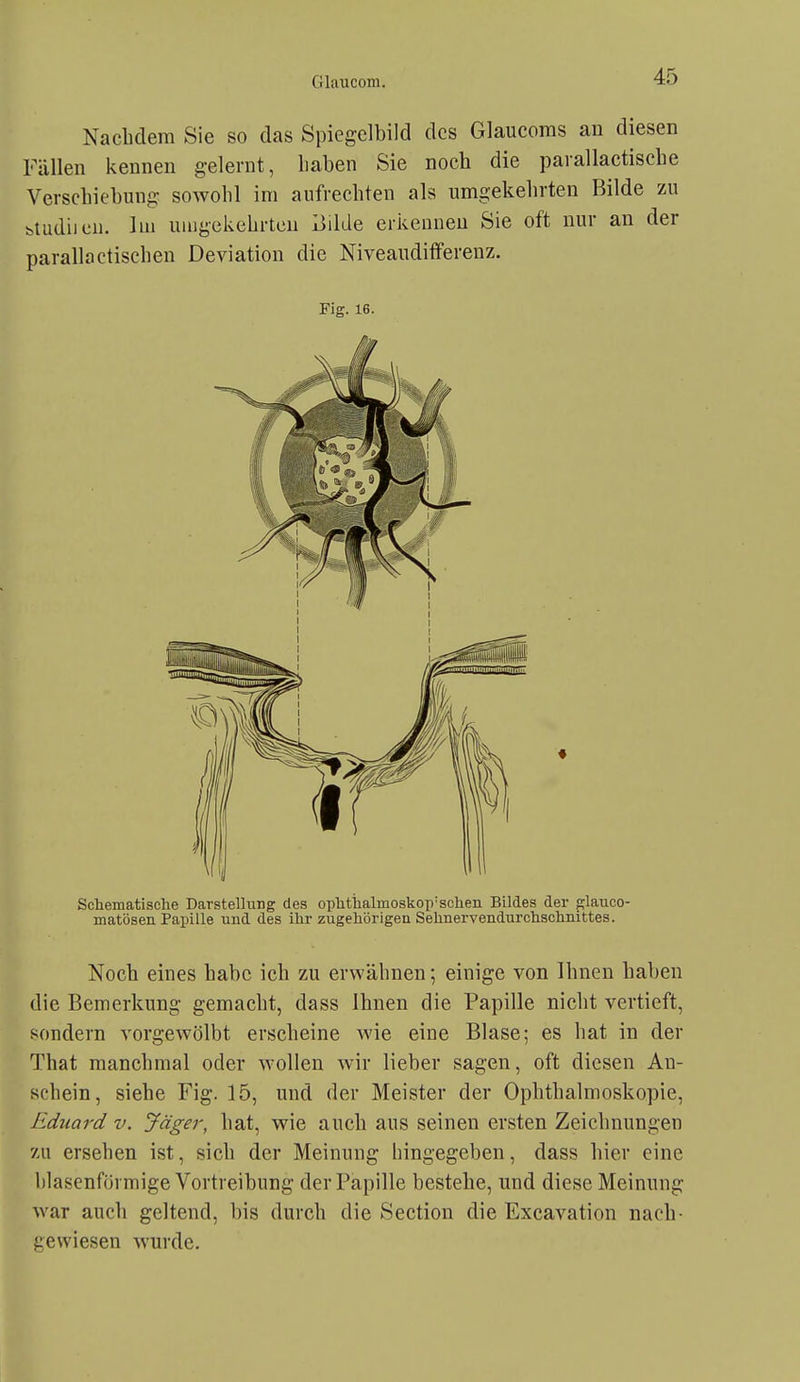 Nachdem Sie so das Spiegelbild des Glaucoms an diesen Fällen kennen gelernt, haben Sie noch die parallactiscbe Verschiebung sowohl im aufrechten als umgekehrten Bilde zu btudiicn. Im uiugckehrteu iiilde erkennen Sie oft nur an der parallactischen Deviation die Niveaudifferenz, Fig. 16. Schematische Darstellung des oplitlialmoskop-schen Bildes der glauco- matösen Papille und des ihr zugehörigen Sehnervendurchschnittes. Noch eines habe ich zu erwähnen; einige von Ihnen haben die Bemerkung gemacht, dass Ihnen die Papille nicht vertieft, sondern vorgewölbt erscheine wie eine Blase; es hat in der That manchmal oder wollen wir lieber sagen, oft diesen An- schein, siehe Fig. 15, und der Meister der Ophthalmoskopie, Eduard v. Jäger, hat, wie auch aus seinen ersten Zeichnungen zu ersehen ist, sich der Meinung hingegeben, dass hier eine blasenförmige Vortreibung der Papille bestehe, und diese Meinung war auch geltend, bis durch die Section die Excavation nach- gewiesen wurde.