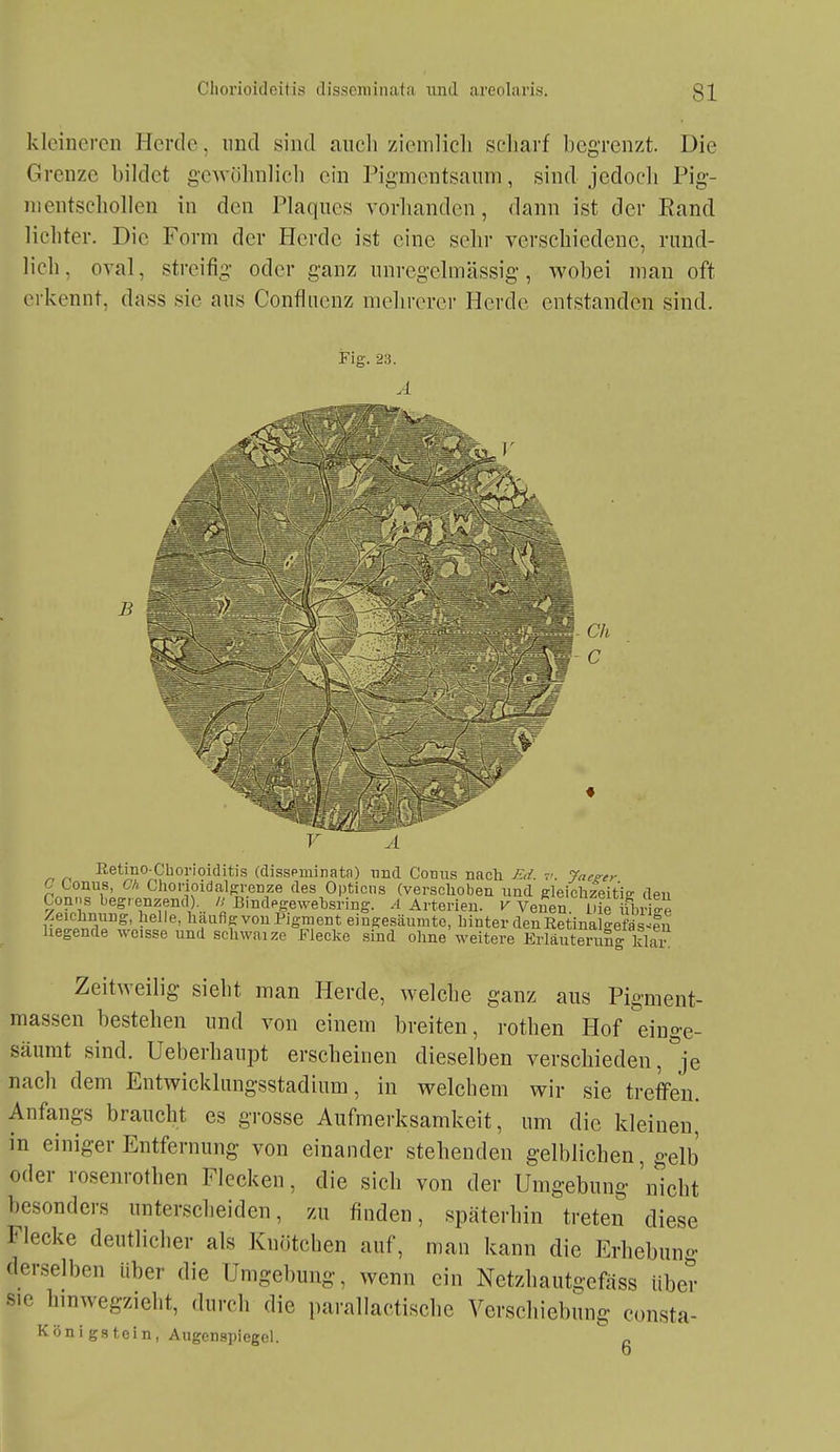 kleineren Herde, und sind aiicli ziemlicli scliarf begrenzt. Die Grenze bildet gwiihnlich ein Pigmentsaum, sind jedocli Pig- nientschollen in den Plaques vorlianden, dann ist der Rand lichter. Die Form der Herde ist eine selir verschiedene, rund- lich, oval, streifig oder ganz unregelmässig, wobei mau oft erkennt, dass sie aus Confincnz mehrerer Herde entstanden sind. Fig. 23. B Eetino Chorioiditis (disspminatn) und Conu.s nach Ed. r: Jaezer C Conus, CA Chonoidalgrenze des Opticus (verschoben und gleiclizeitie: den Conns beg> enzend). n BindPgewehsring. .1 Arterien, v Ve^el l.ie übr iloi-Ä' li'iifigvonPjgment eingesäumte, hinter denRetinalgefa-s 'en hegende weisse und schwaize Flecke sind ohne weitere Erläuterung Idai- Zeitweilig sieht man Herde, welche ganz aus Pigment- massen bestehen und von einem breiten, rothen Hof einge- säumt sind. Ueberhaupt erscheinen dieselben verschieden, je nach dem Entwicklungsstadium, in welchem wir sie treffen. Anfangs braucht es grosse Aufmerksamkeit, um die kleinen, in einiger Entfernung von einander stehenden gelblichen, gelb oder rosem-othen Flecken, die sich von der Umgebung 'nicht besonders unterscheiden, zu finden, späterhin treten diese Flecke deutlicher als Knötchen auf, man kann die Erhebung derselben über die Umgebung, wenn ein Netzhautgefäss über sie hmwegzieht, durch die parallaetische Verschiebung consta- Königstein, Augenspiegel. „ 0