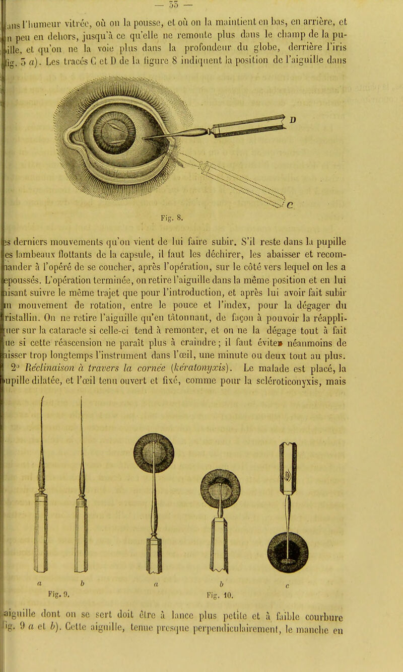 Uaiisriiunieur vitrée, où on la pousse, eloù on la mainliontcn bas, en arrière, et n peu en dehors, jusqu'à ce qu'elle ne remonte plus clans le champ de la pu- lille, et qu'on ne la voie plus dans la profondenr du globe, derrière l'iris fig. 5 a). Les tracés C et D de la ligure 8 indiquent ia position de l'aiguille dans Fig. 8. îs derniers mouvements qu'on vient de lui faire subir. S'il reste dans la pupille es lambeaux flottants de la capsule, il faut les déchirer, les abaisser et recom- lander à l'opéré de se coucher, après l'opération, sur le côté vers lequel on les a epoussés. L'opération terminée, on retire l'aiguille dans la même position et en lui lisant suivre le même trajet que pour l'introduction, et après lui avoir fait subir m mouvement de rotation, entre le pouce et l'index, pour la dégager du ristallin. On ne retire l'aiguille qu'en tâtonnant, de façon à pouvoir la réappli- ner sur la cataracte si celle-ci tend à remonter, et on ne la dégage tout à fait ne si cette réascension ne paraît pins à craindre ; il faut évite» néanmoins de lisser trop longtemps l'instrument dans l'œil, une minute ou deux tout au plus. 2' Réclinaison à travers la cornée [kéralonyxis]. Le malade est placé, la upille dilatée, et l'œil tenu ouvert et fixé, comme pour la scléroticonyxis, mais a b a b Fig. 9. Fig. iO. aiguille dont on se sert doit être à lance plus petite et à faible courbure