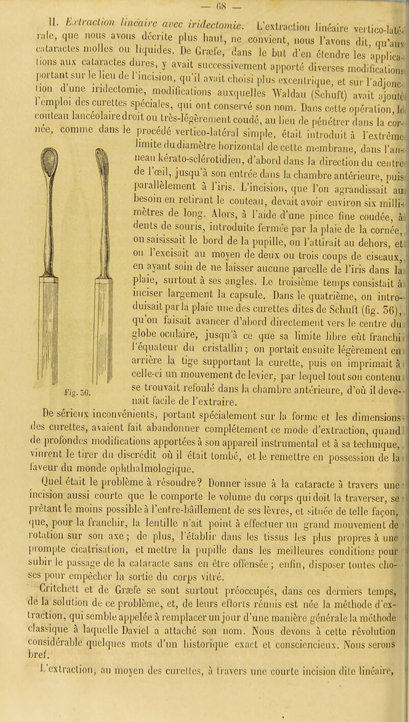 II. Exlraclion linéaire avec irideclomie. L'exlracLioi. linéaire veilico-IaL,'. raie, que nous avons décrite plus haut, ne convient, nous l'avons dit, qu'a.n cntaracles molles ou liquides. De Gracie, dans le but d'en élcndre les apnlin lions aux cataractes dures, y avait successivement apporté diverses modification- portant sur le heu de 1 incision, qu'il avait choisi plus excentrique, et sur l'adjonr lion dune mdectomie, modifications auxquelles Waldau (Schuft) avait a oui, 1 emploi des curettes spéciales, qui ont conservé son nom. Dans cotte opération, h couteau lanceolaire droit ou très-légèrement coudé, au lieu de pénétrer dans la cor- née, comme dans le procédé vertico-latéral simple, était introduit à lextrèm. limite du diamètre horizontal de cette m-imbrane, dans l'an- neaiikérato-sclérotidieu, d'abord dans la direction du ceiiti , de l'œil, jusqu'à son entrée dans la chambre antérieure, puis parallèlement à l'iris. L'incision, que Ton agrandissait au besoin en retirant le couteau, devait avoir environ six milli- mètres de long. Alors, à l'aide d'une pince fine coudée, dents de souris, introduite fermée par la plaie de la cornée, on saisissait le bord de la pupille, on l'attirait au dehors, cl on l'excisait au moyen de deux ou trois coups de ciseaux, en ayant soin de ne laisser aucune parcelle de l'iris dans la plaie, surtout à ses angles. Le troisième temps consistait à inciser largement la capsule. Dans le quatrième, on intro- duisait parla plaie une des curettes dites de Schui't (fig. 56), qu'on faisait avancer d'abord directement vers le centre du globe oculaire, jusqu'à ce que sa limite libre eût franchi l'équaleur du cristallin ; on portait ensuite légèrement en aiTière la tige supportant la curette, puis on imprimait à celle-ci un mouvement de levier, par lequel tout son contenu Fig. 56. trouvait refoulé dans la chambre antérieure, d'où il deve- nait facile de l'extraire. D.e sérieux inconvénients, portant spécialement sur la forme et les dimensions? des curettes, avaient fait abandonner complètement ce mode d'extraction, quandl de profondes modifications apportées à son appareil instrumental et à sa technique,. vinrent le tirer du discrédit où il était tombé, et le remettre en possession de lai faveur du monde ophthalmologique. Quel était le problème à résoudre? Donner issue à la cataracte à travers une mcision aussi courte que le comporte le volume du corps qui doit la traverser, se prêtant le moins possible à l'enlre-bàillement de ses lèvres, et située de telle façon, «pie, pour la franchir, la lentille n'ait point à effectuer un grand mouvement de rotation sur son axe ; de plus, l'établir dans les tissus les plus propres à une prompte cicatrisation, et mettre la [jupille dans les meilleures conditions pour subir le passage de la cataracte sans en être offensée ; enfin, disposer toutes cho- ses pour empêcher la sortie du corps vitré. Critchett et de Grsel'e se sont surtout préoccupés, dans ces derniers temps, de la solution de ce problème, et, de leurs eflorls réunis est née la méthode d'ex- traction, qui semble appelée à remplacer un jour d'une manière générale la méthode classique à laquelle Daviel a attaché son nom. Nous devons à cette révolution considérable quelqnes mots d'un historique exact et consciencieux. Nous serons bre/. L'extraction, au moyen des curellcs, à travers une courte incision dite linéaire,