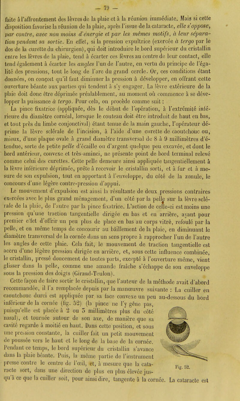 - 70 - faite à l'affrontement des lèvres de la plaie et à la réunion immédiate. Mais si cette disposition favorise la réunion de la plaie, après l'issue de la cataracte, elle s oppose, par contre, avec non moins d'énergie et par les mêmes motifs, à leur sépara- tion pendant sa sortie. En effet, si la pression expultrice (exercée à tergo par le dos de la curette du chirurgien), qui doit introduire le bord supérieur du cristallin entre les lèvres de la plaie, tend à écarter ces lèvres au centre de leur contact, elle tend également à écarter les angles l'un de l'autre, en vertu du principe de l'éga- lité des pressions, tout le long de l'arc du grand cercle. Or, ces conditions étant données, on conçoit qu'il faut diminuer la pression à développer, en offrant cette ouverture béante aux parties qui tendent à s'y engager. La lèvre extérieure de la plaie doit donc être déprimée préalablement, au moment où commence à se déve- lopper la puissance à tergo. Pour cela, on procède comme suit : La pince fixatrice (appliquée, dès le début de l'opération, à l'extrémité infé- rieure du diamètre cornéal, lorsque le couteau doit être introduit de haut eu bas, et tout près du limbe conjonctival) étant tenue de la main gauche, l'opérateur dé- prime la lèvre sclérale de l'incision, à l'aide d'une curette de caoutchouc ou, mieux, d'une plaque ovale à grand diamètre transversal de 8 à 9 millimètres d'é- tendue, sorte de petite/3e//e d'écaillé ou d'argent quelque peu excavée, et dont le bord antérieur, convexe et très-aminci, ne présente point de bord terminal relevé comme celui des curettes. Cette pelle demeure ainsi appliquée tangentiellement à la lèvre inférieure déprimée, prête à recevoir le cristallin sorti, et à fur et à me- sure de son expulsion, tout en apportant à l'enveloppe, du côté de la zonule, le concours d'une légère contre-pression d'appui. Le mouvement d'expulsion est ainsi la résultante de deux pressions contraires exercées avec le plus grand ménagement, d'un côté par la pelle sur la lèvre sclé- l ale de la plaie, de l'autre par la pince fixatrice. L'action de celle-ci est moins une pression qu'une traction taugentielle dirigée en bas et en arrière, ayant pour premier elfet d'offrir un peu plus de place en bas au corps vitré, refoulé par la pelle, et en même temps de concourir au bâillement de la plaie, en diminuant le diamètre transversal de la cornée dans un sens propre à rapprocher l'un de l'autre les angles de cette plaie. Cela fait, le mouvement de traction taugentielle est accru d'une légère pression dirigée en arrière, et, sous cette influence combinée, le cristallin, pressé doucement de toutes parts, excepté à l'ouverture même, vient glisser dans la pelle, comme une amande fraîche s'échappe de son enveloppe sous la pression des doigts (Giraud-Teulon). Cette façon de faire sortir le cristallin, que l'auteur de la méthode avait d'abord recommandée, il l'a remplacée depuis par la manœuvre suivante : La cuiller en caoutchouc durci est appliquée par sa lace convexe un peu au-dessous du bord inférieur de la cornée (fig. 52) (la pince ne l'y gêne pas, puisqu'elle est placée à 2 ou 3 millimètres plus du côté nasal), et tournée autour de son axe, de manière que sa cavité regarde à moitié eu haut. Dans cette position, et sous nue pression constante, la cuiller fait un petit mouvement de poussée vers le haut et le long de la base de la cornée. ^ Pendant ce temps, le bord supérieur du cristallin s'avance dans la plaie béante. Puis, la même |)artic de l'iustrumcnt presse contre le centre de l'œil, et, à mesure que la cata- j,,, j.,^ racte sort, dans une direction de plus en plus élevée jus- '^^ ' qu'à ce que la cuiller soit, pour ainsi dire, tangente à la cornée. La cataracte est
